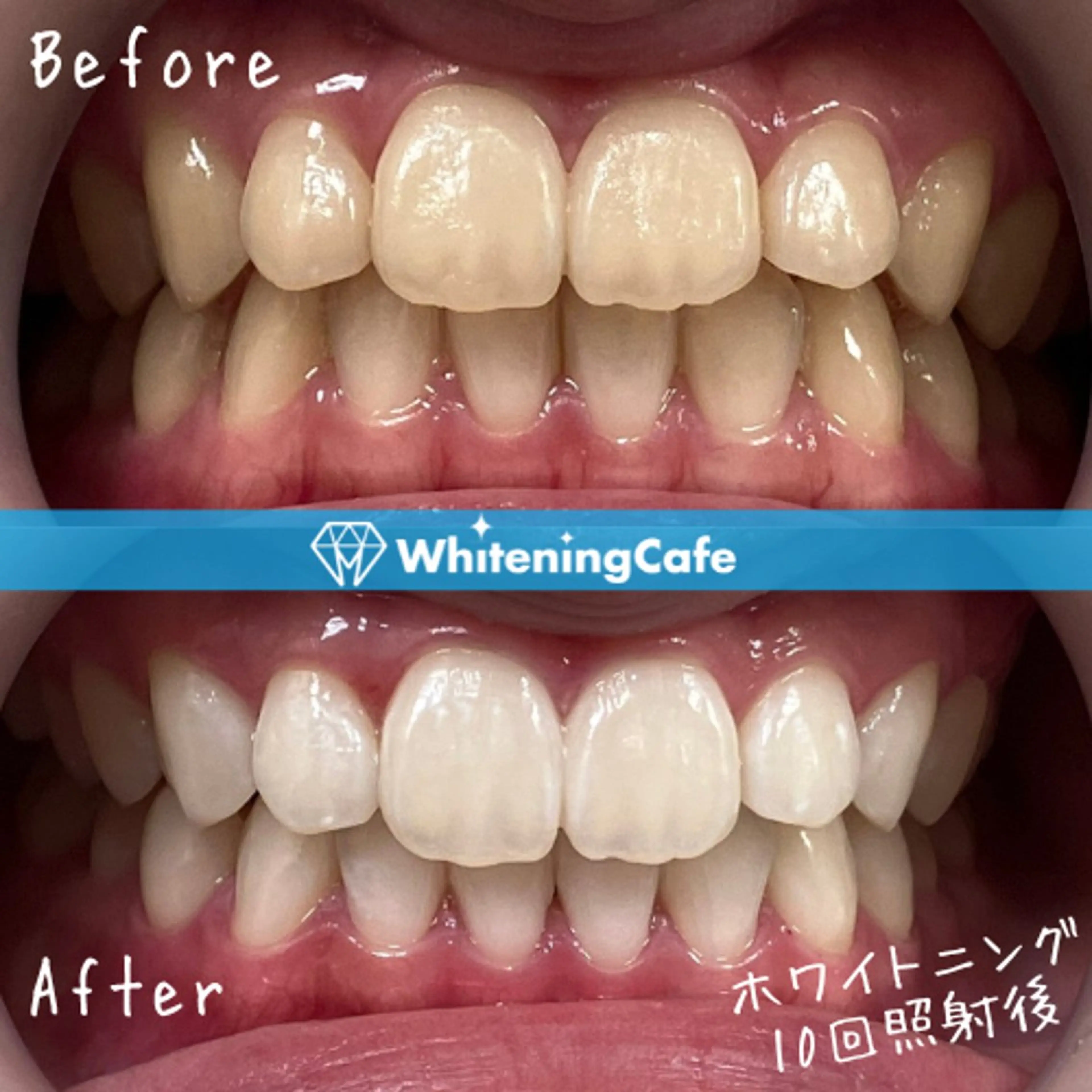 ホワイトニングカフェ徳島沖浜店所属・ホワイトニングカフェ 徳島沖浜店のエステ・リラクイメージ