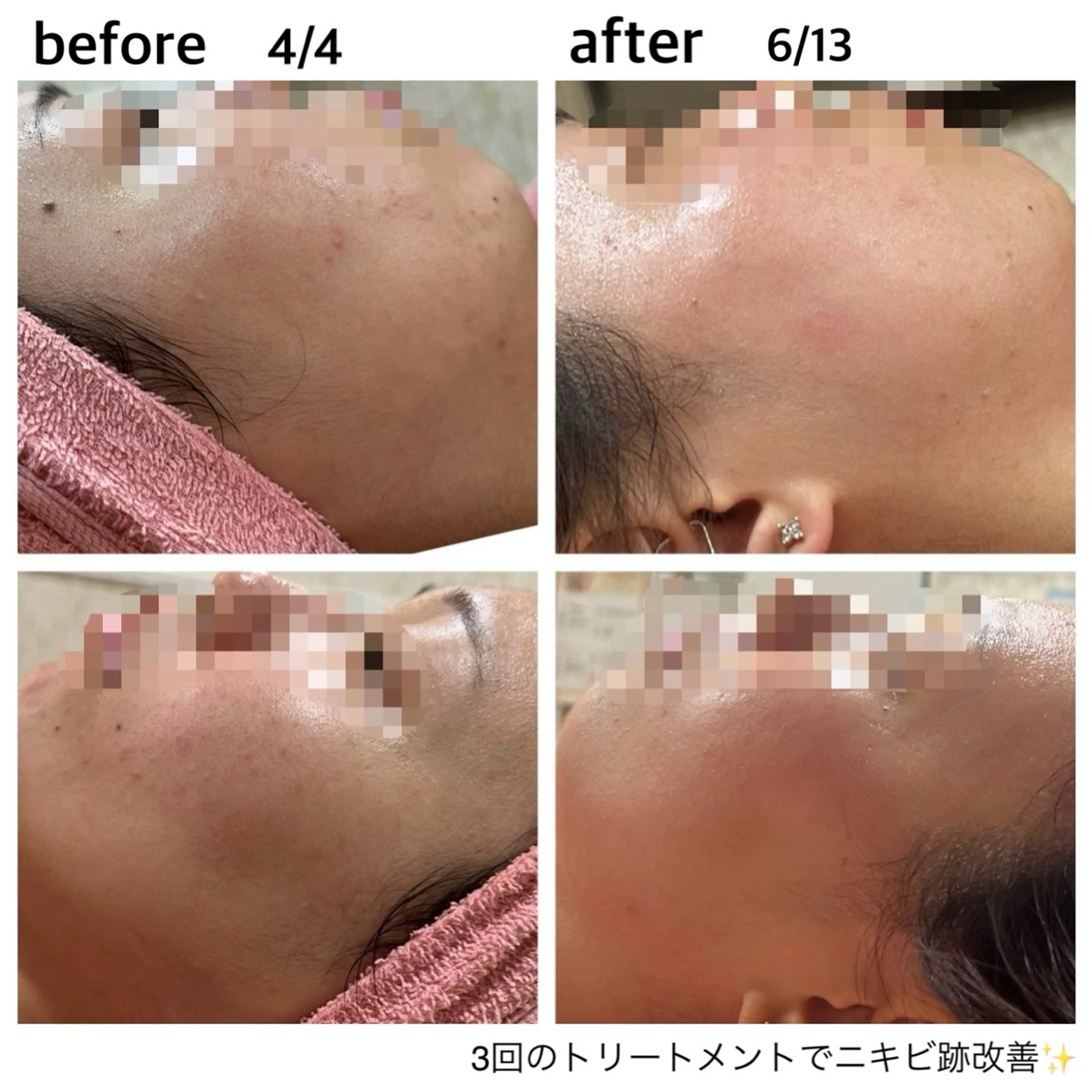 エステ フェイシャル/脱毛 ジョアアンジェ竹田のエステ・リラクイメージ