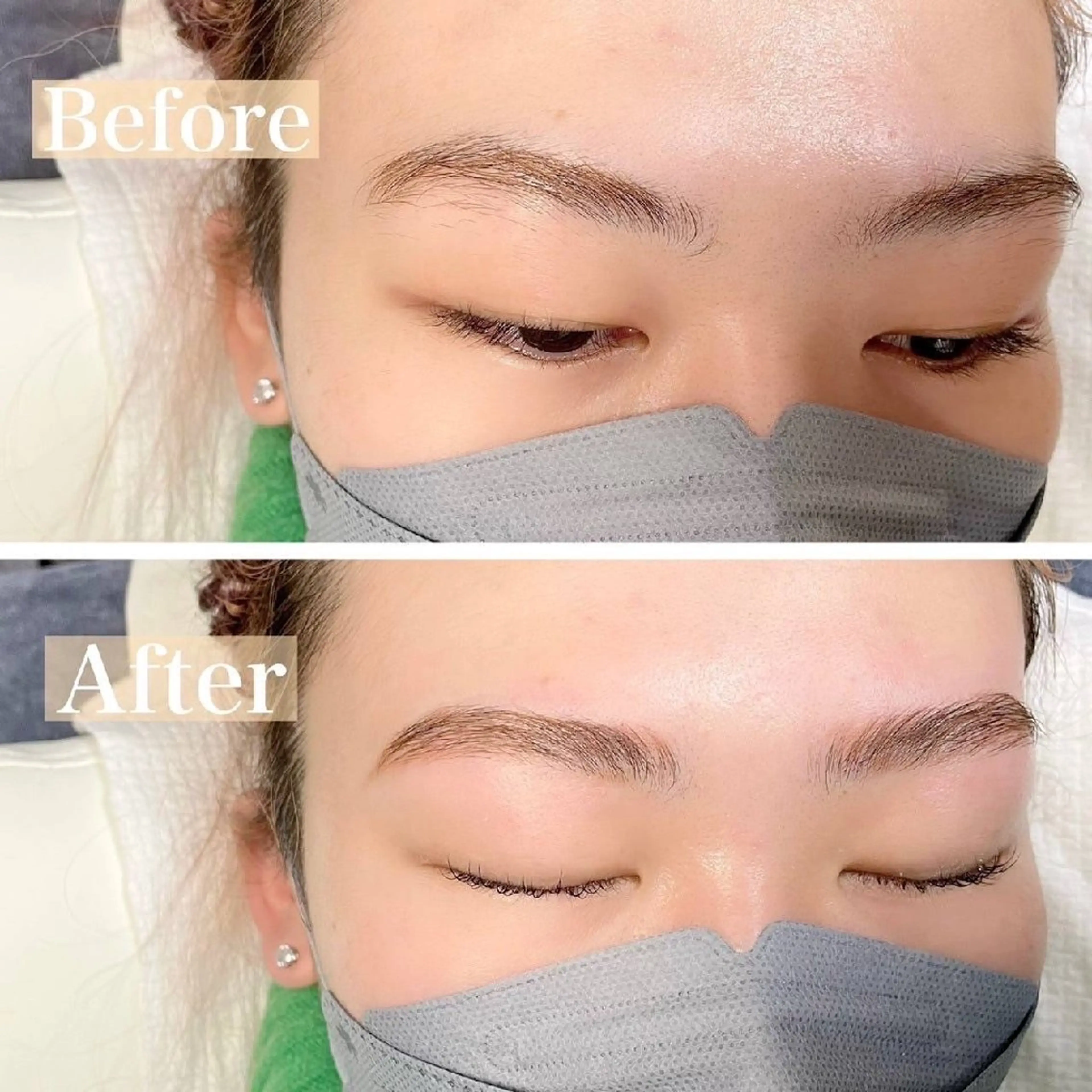 ミニモ限定２４歳以下🐇眉周りオーガニックワックス脱毛の写真