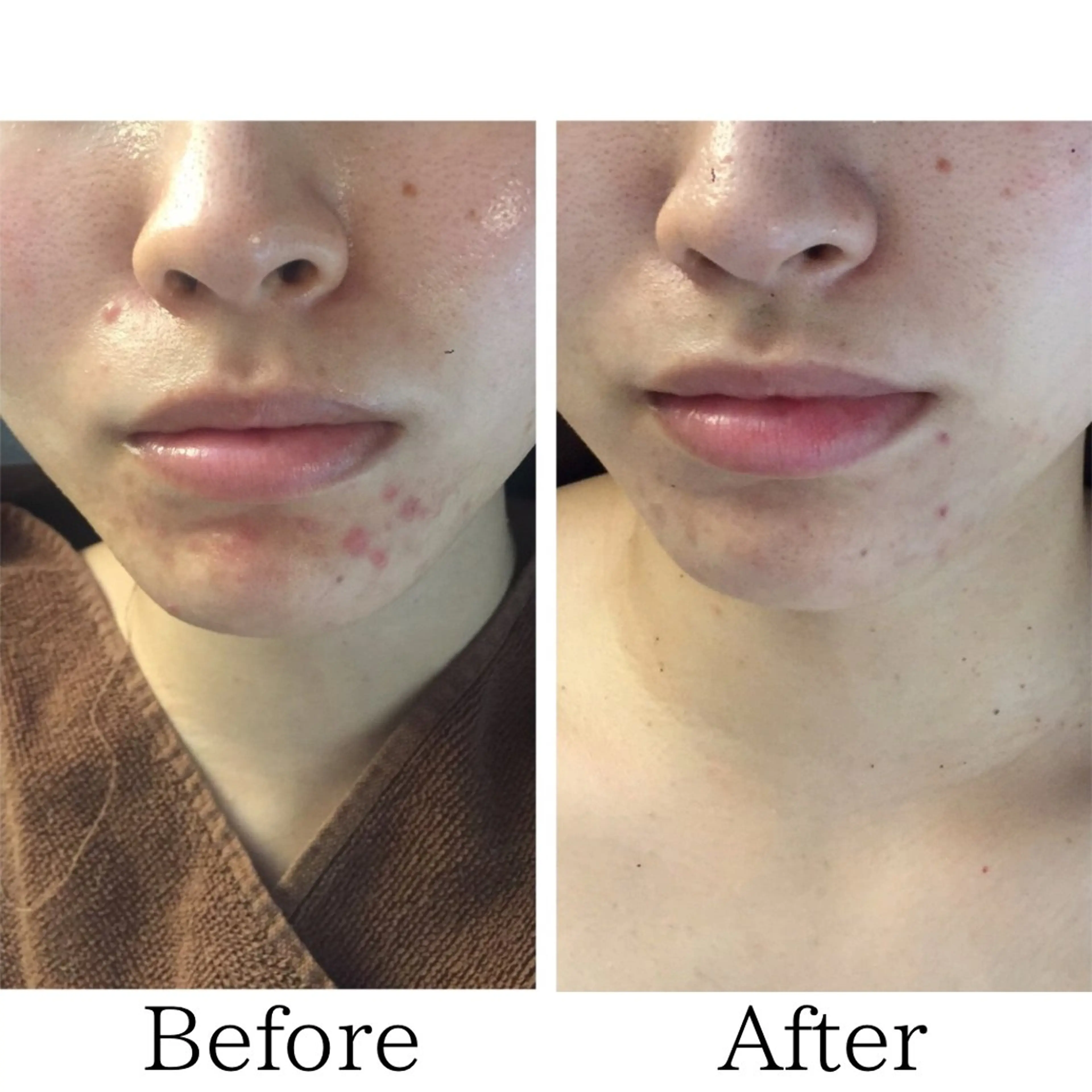 エステ 毛穴ニキビ専門 ビューティーグランツのエステ・リラクイメージ