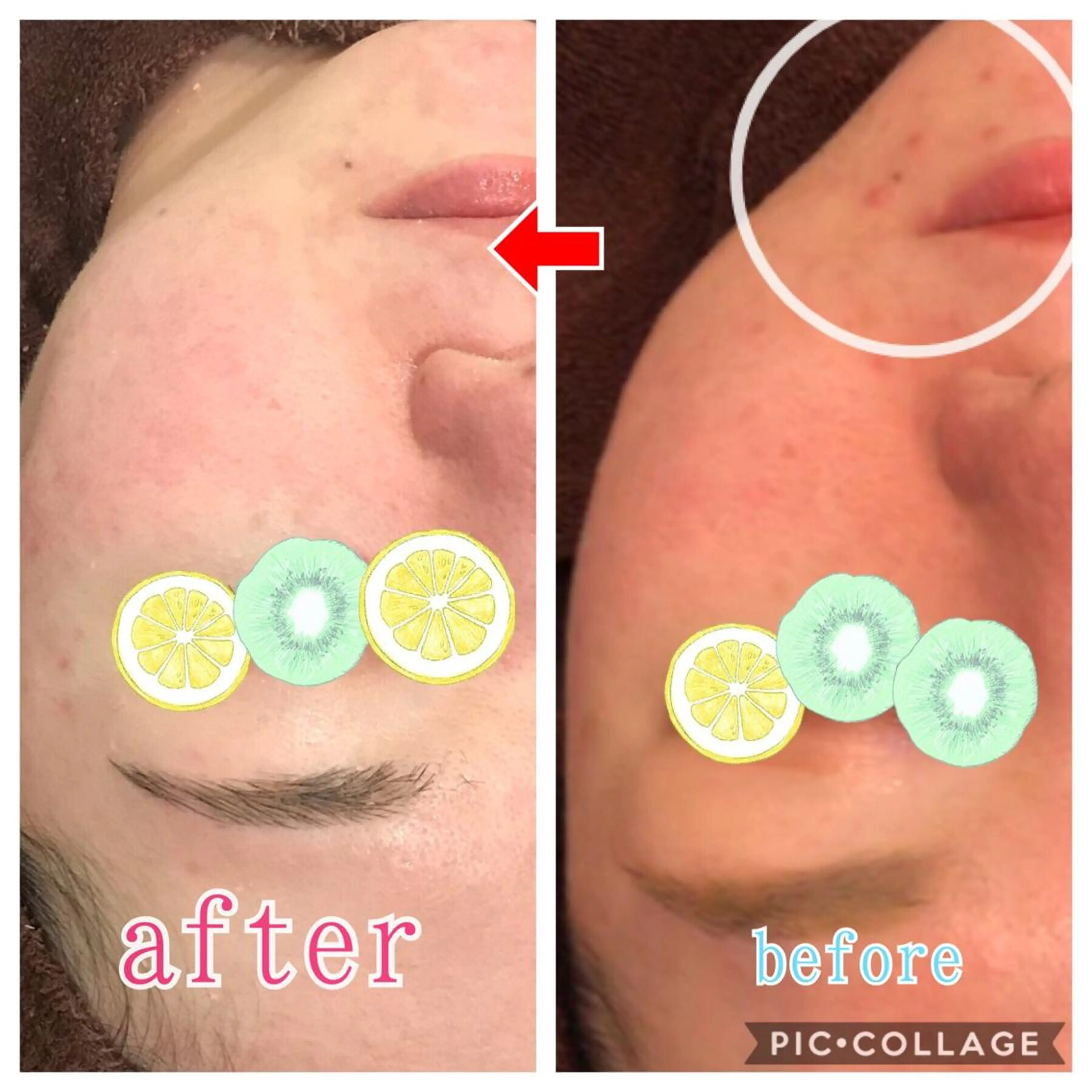 セミロング カラー パーマ ヘアアレンジ メンズ キッズ ネイル マツエク・マツパ 金の糸脱毛 産毛ケア専門のエステ・リラクイメージ