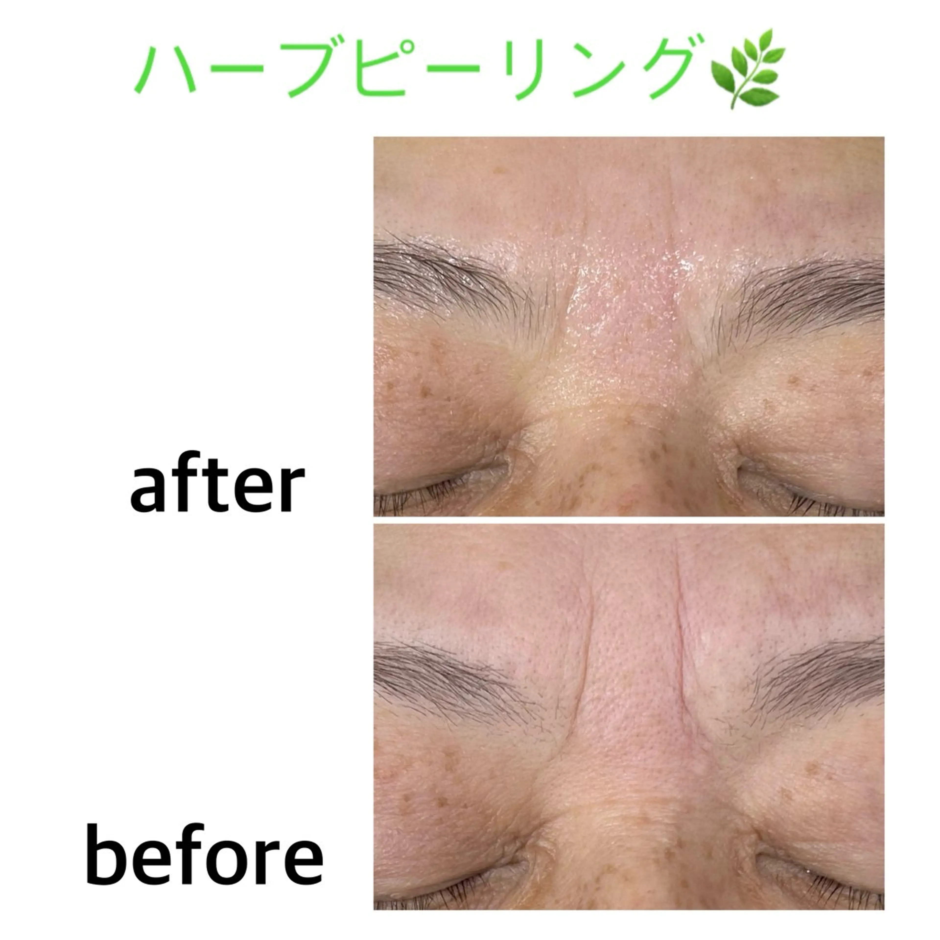 エステ soposilma 🧸今季OPENのマツエク・マツパデザイン