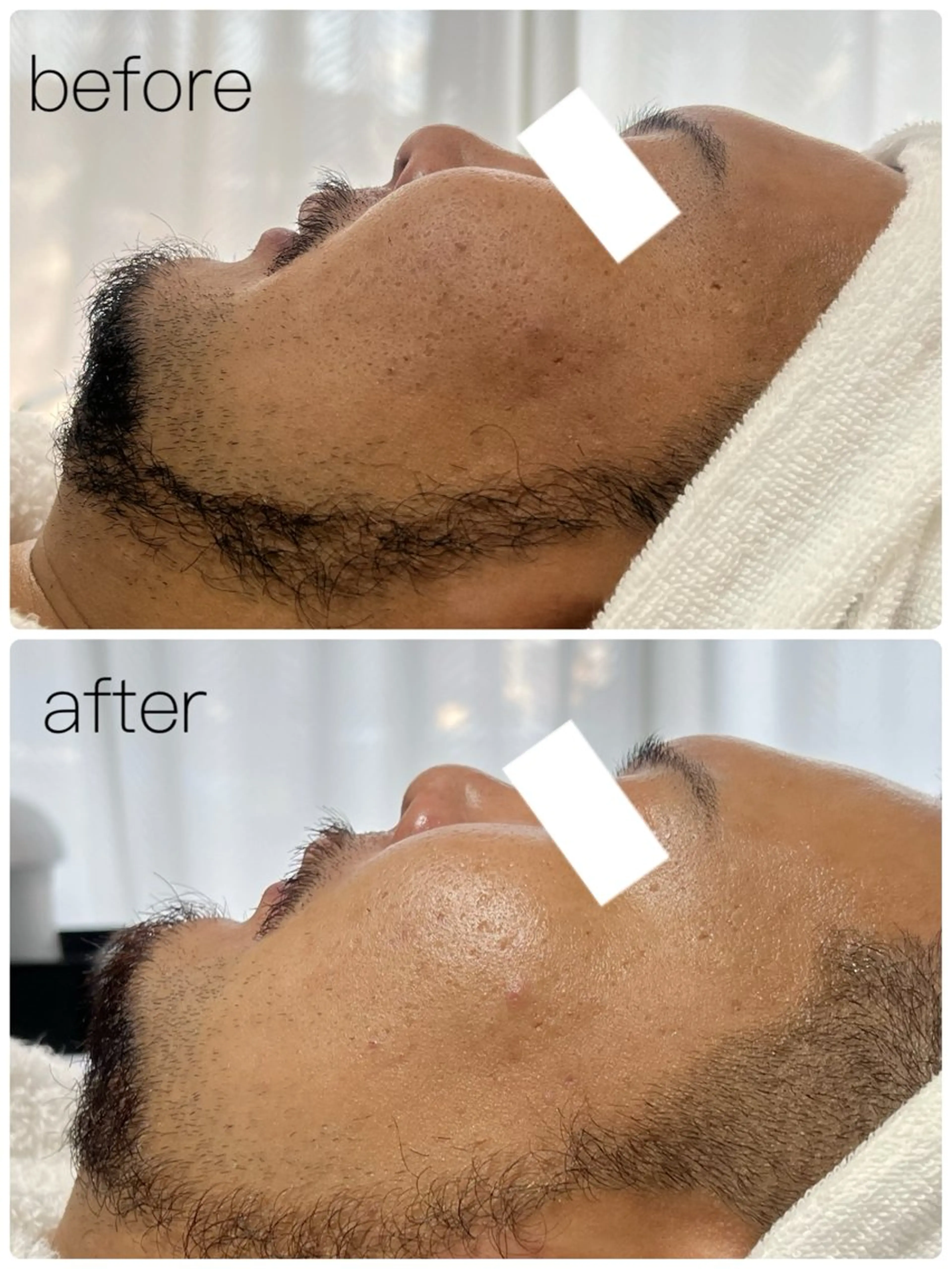 ROR Akariのエステ・リラクイメージ