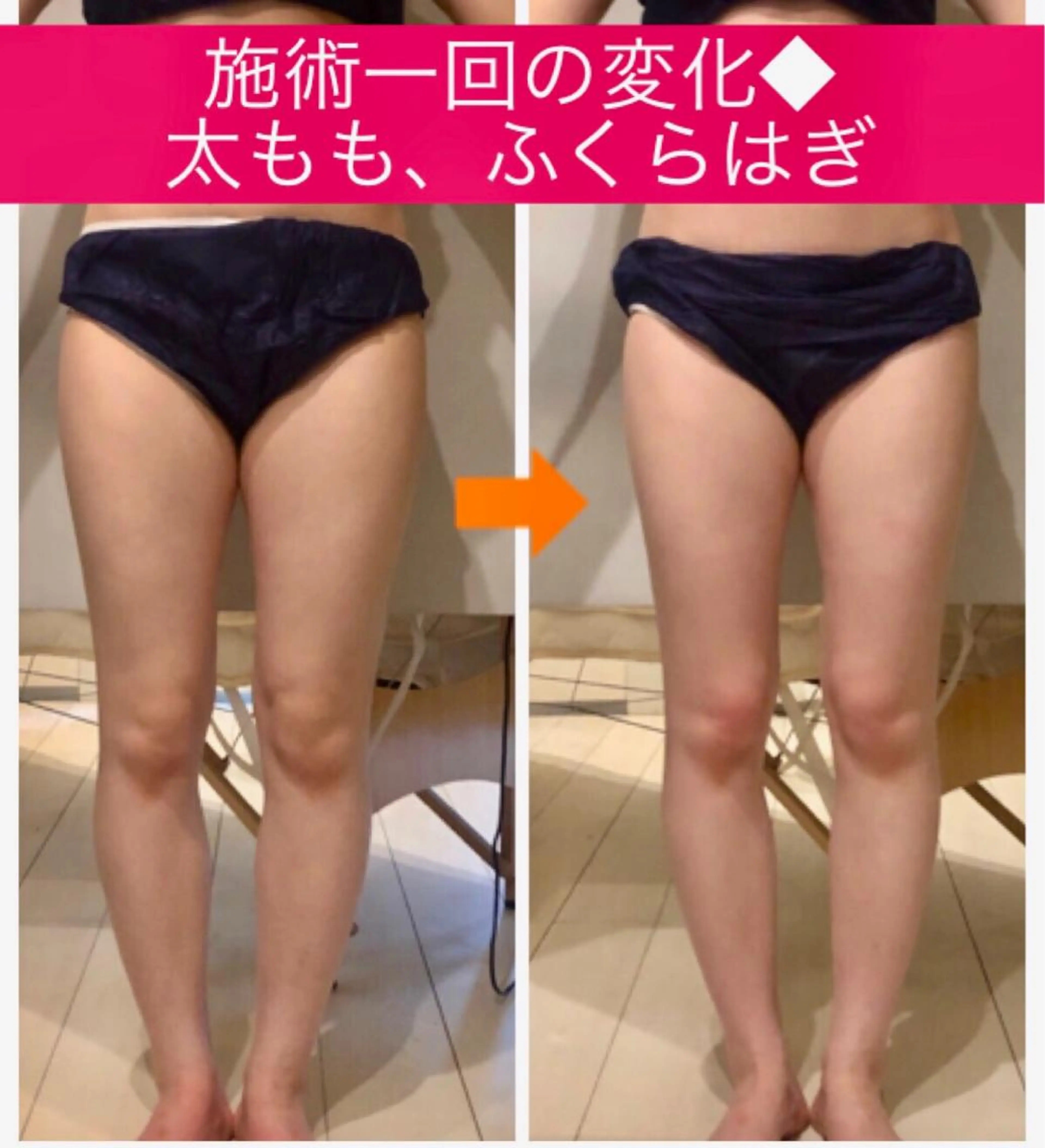 ロング カラー パーマ ヘアアレンジ メンズ キッズ ネイル マツエク・マツパ くびれヘア 小顔カット ‍痩身＆ボディ 結果出し🌟丹野のエステ・リラクイメージ