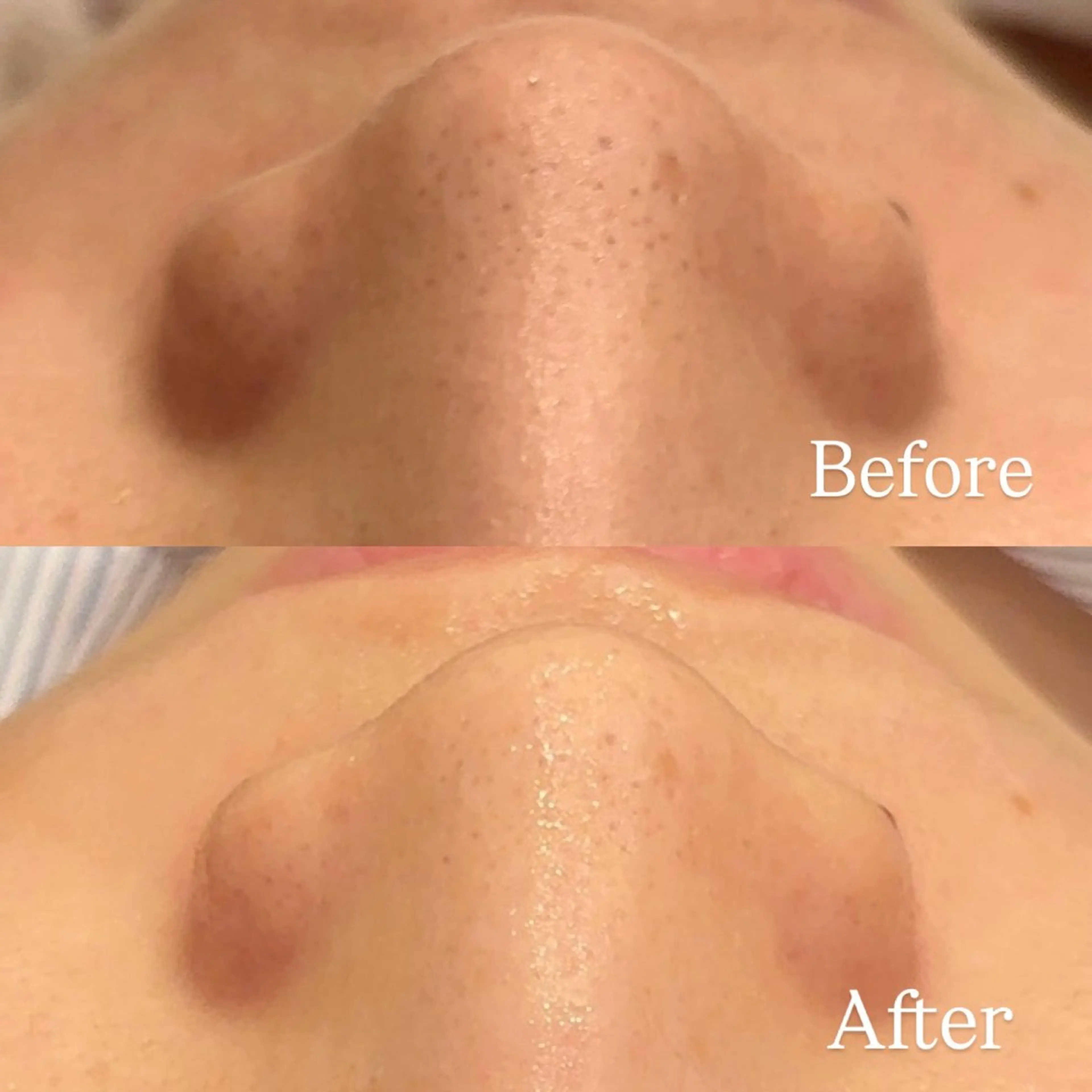 Hari Lounge恵比寿所属・chika🦋 ハリラウンジ恵比寿のエステ・リラクイメージ