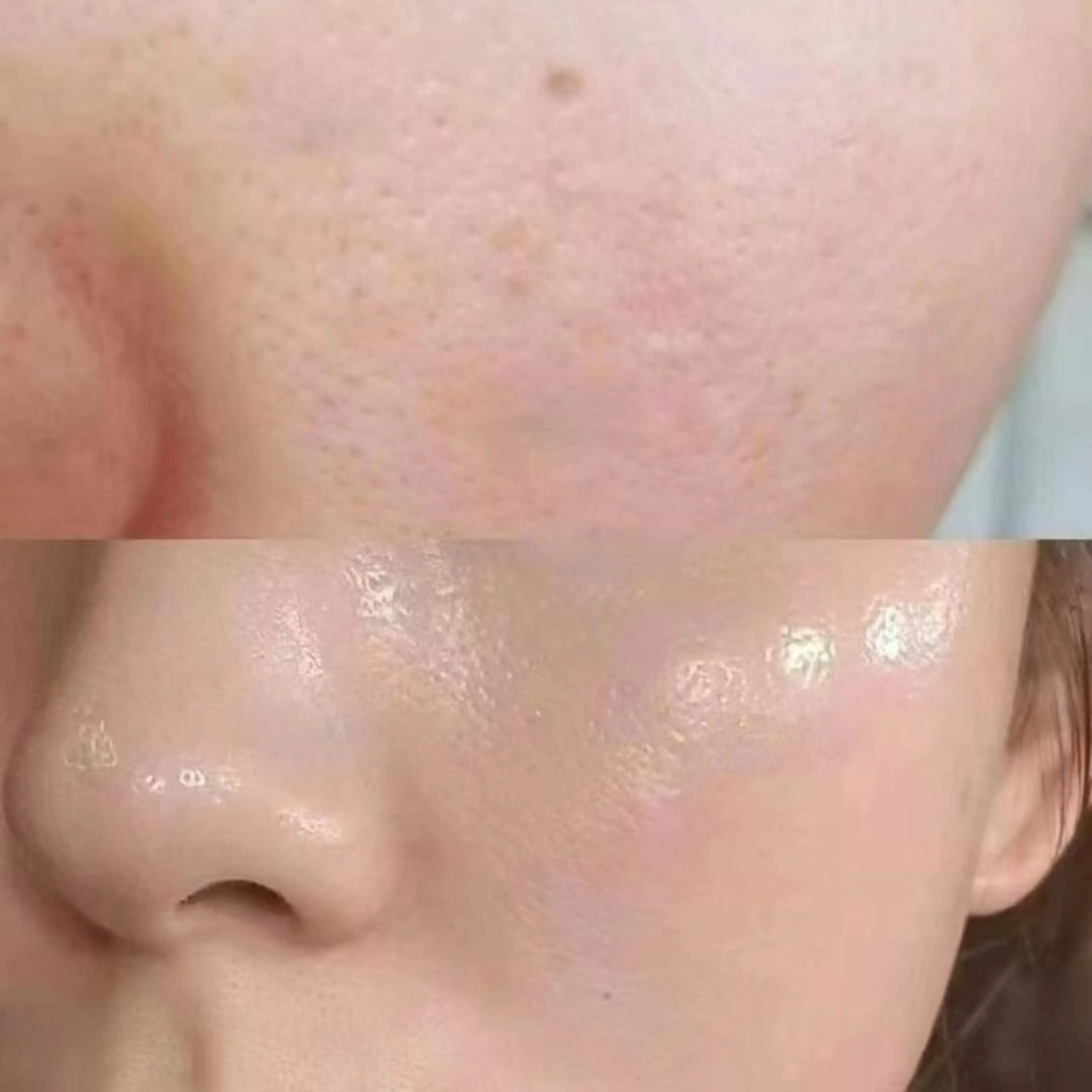 マツエク・マツパ エステ aliaハイフ&水光ジェットサロン所属・aliaハーブ水光店 エステティシャン募集のエステ・リラクイメージ