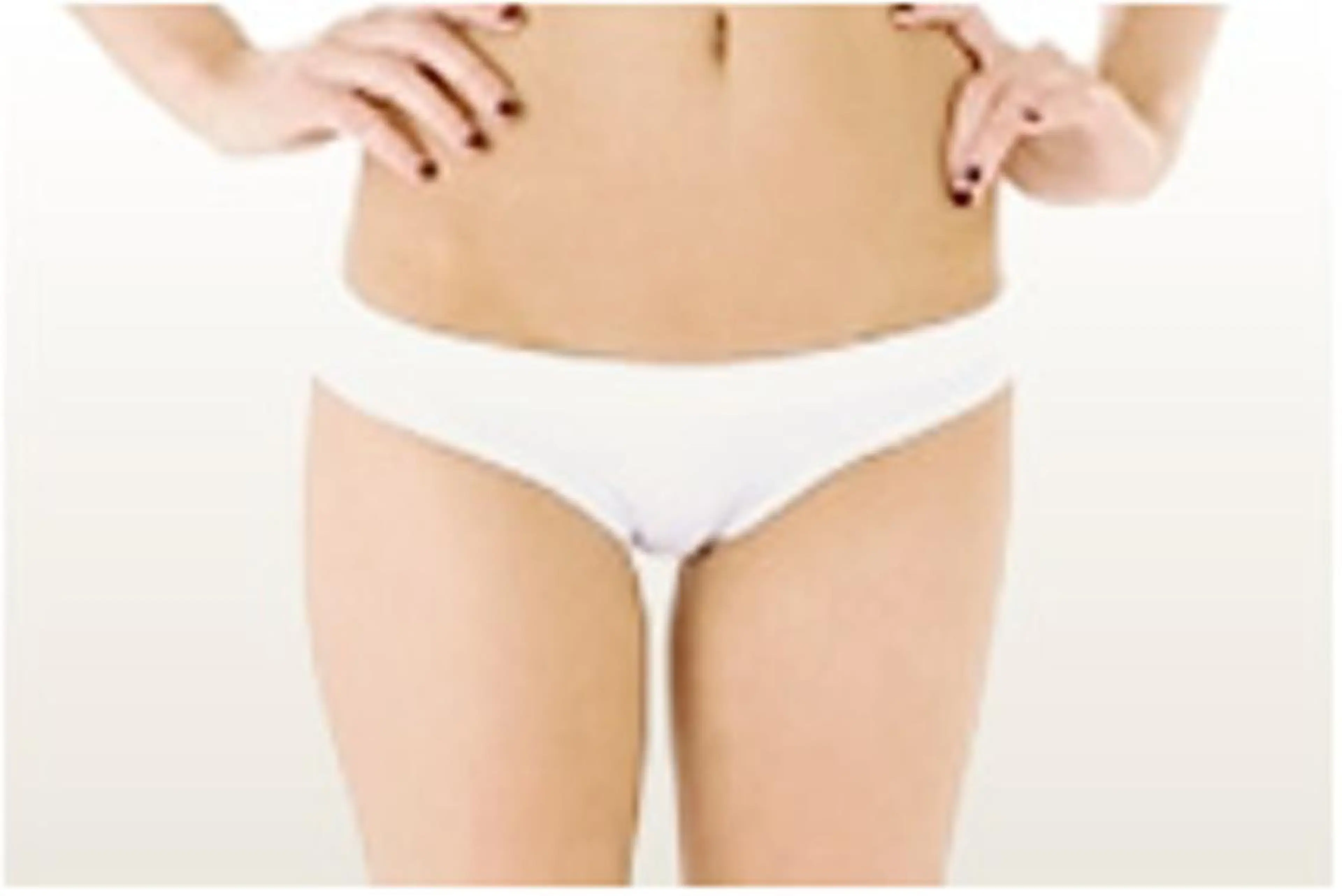 【新規】ブラジリアンワックスVIO脱毛体験の写真