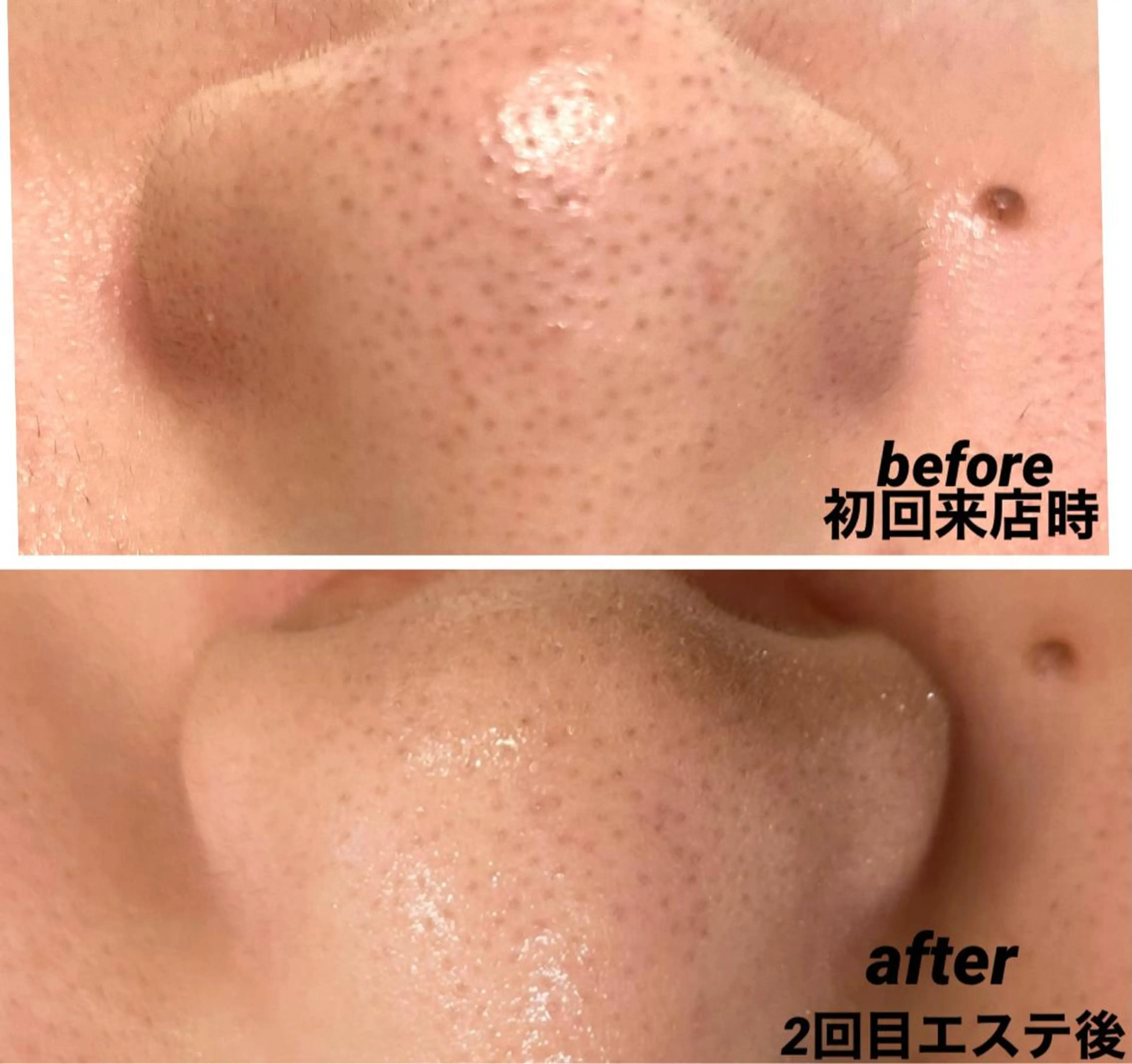 エステ 小林 玲菜のエステ・リラクイメージ