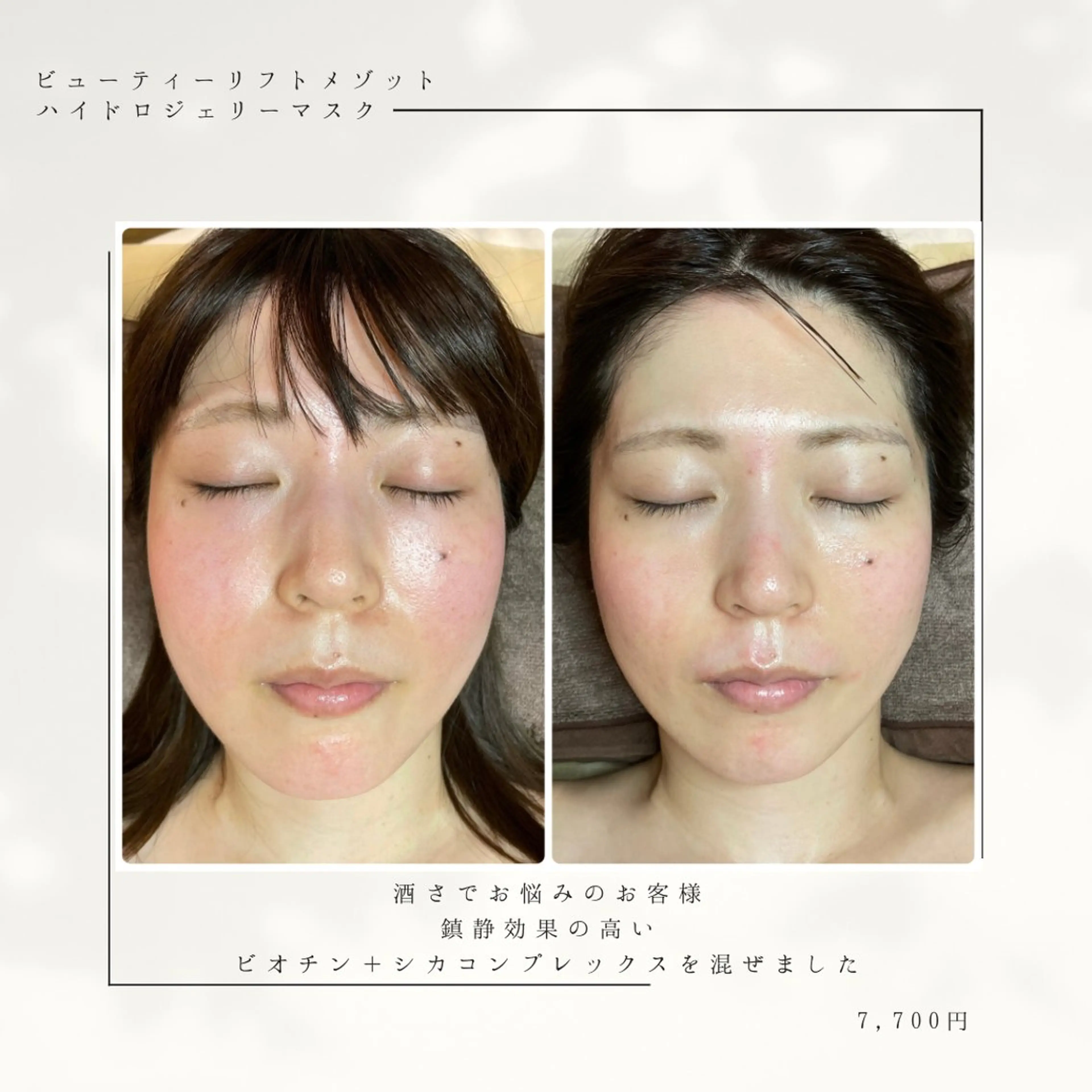 代表 MOMOのエステ・リラクイメージ