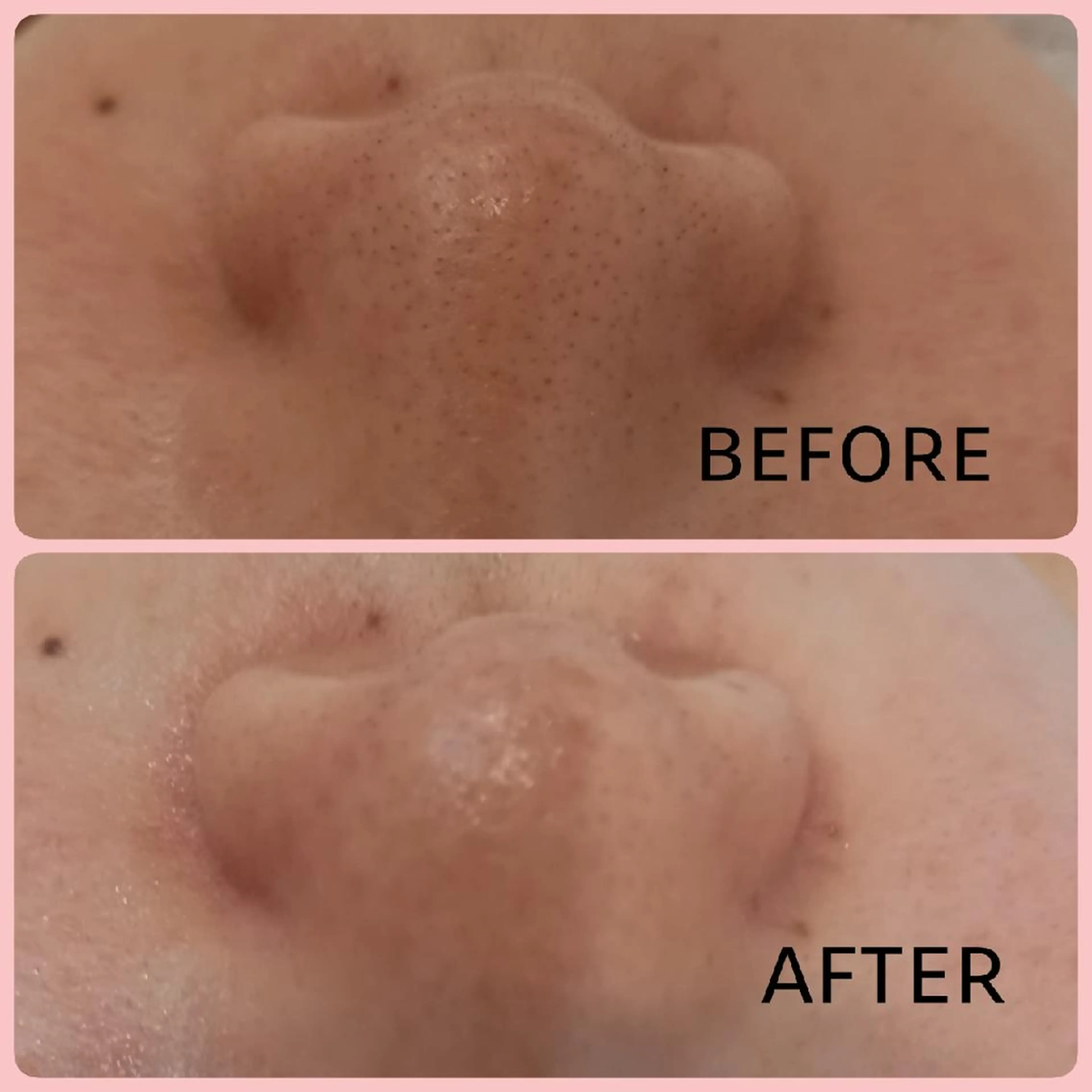 エステ 小野 恵のエステ・リラクイメージ