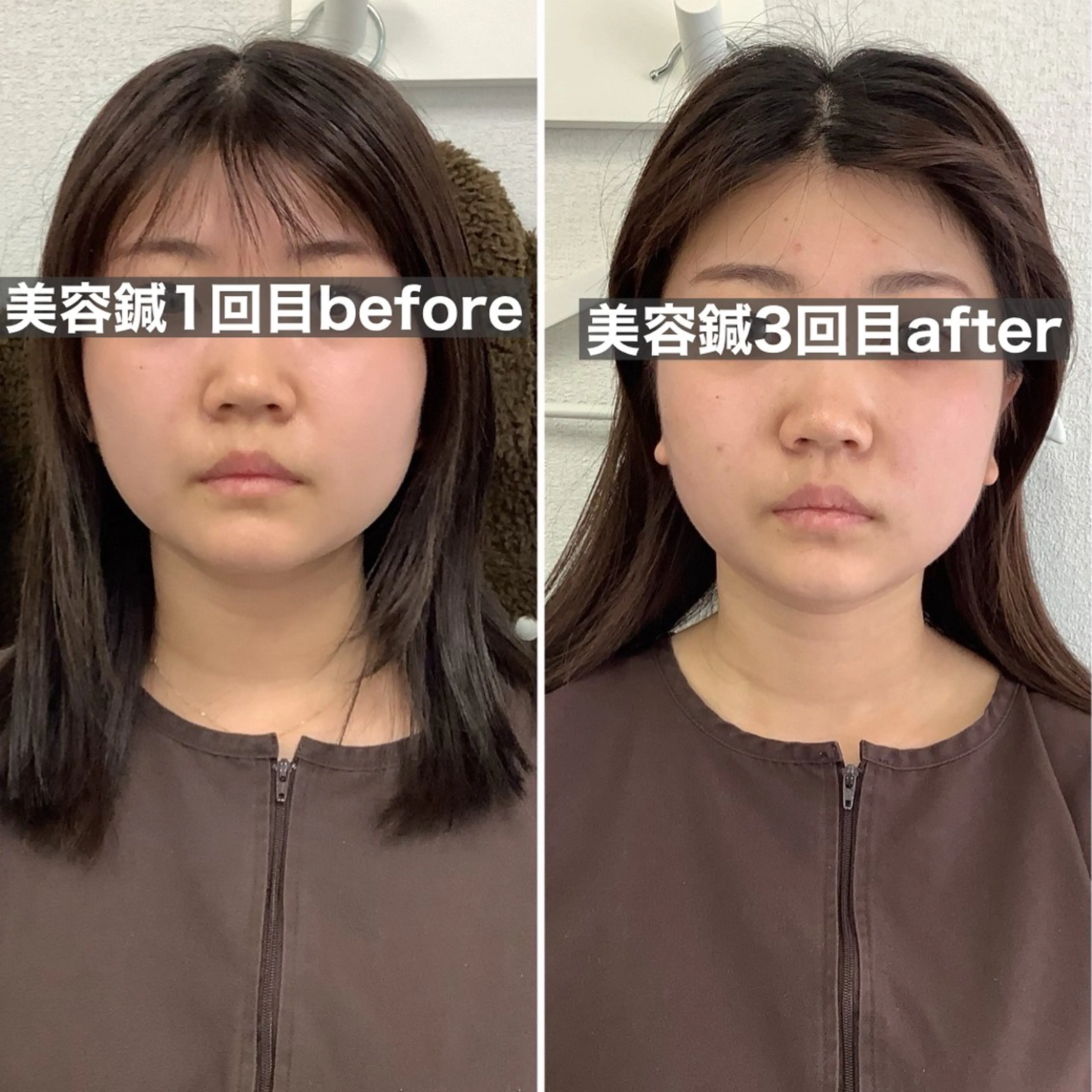 エステ リラク ハリサロンドオフ 美容鍼灸×小顔整体のエステ・リラクイメージ