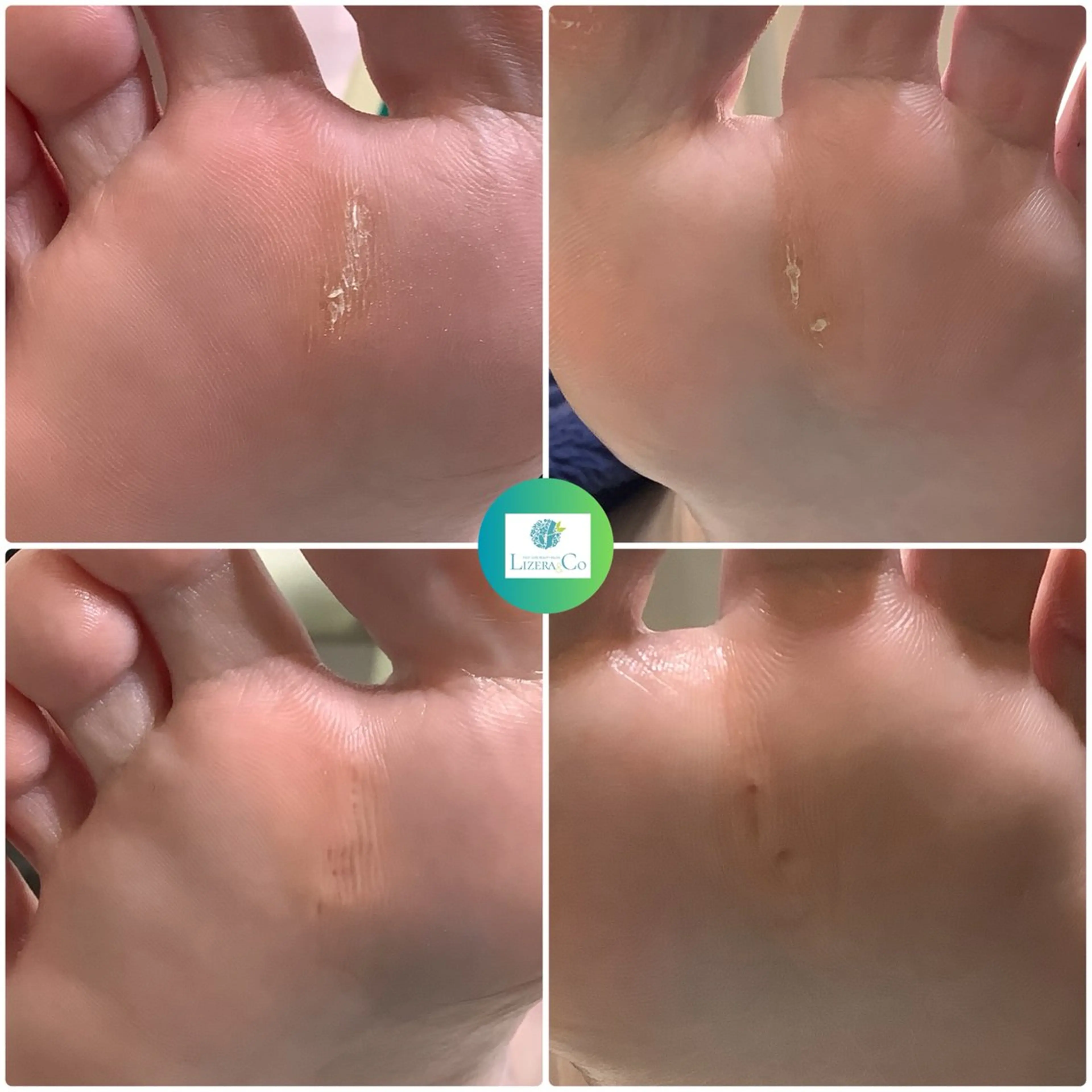 リゼラアンドコー たまプラーザ店のネイルデザイン