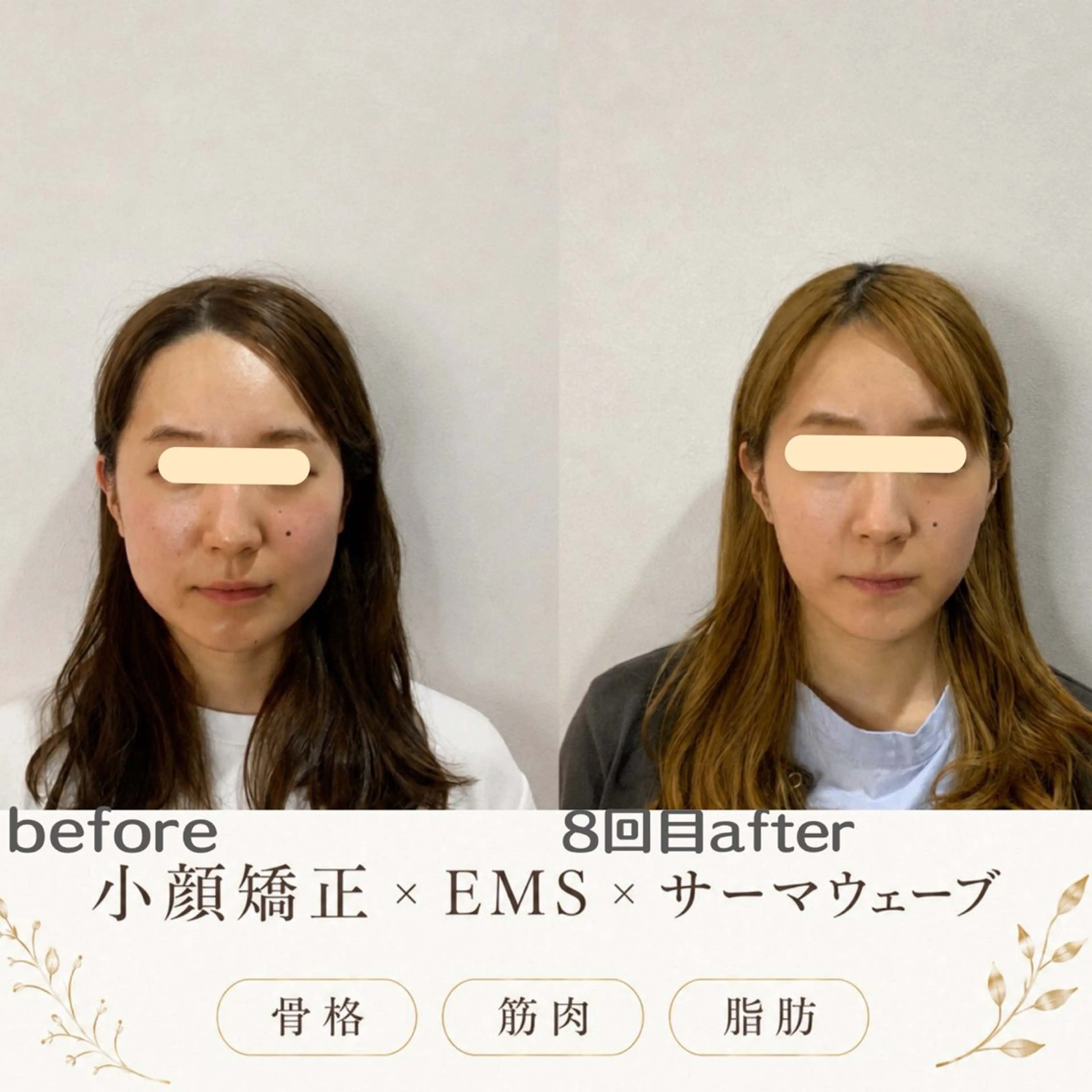 エステ リラク 最速小顔・肌質管理 espoirマキのエステ・リラクイメージ