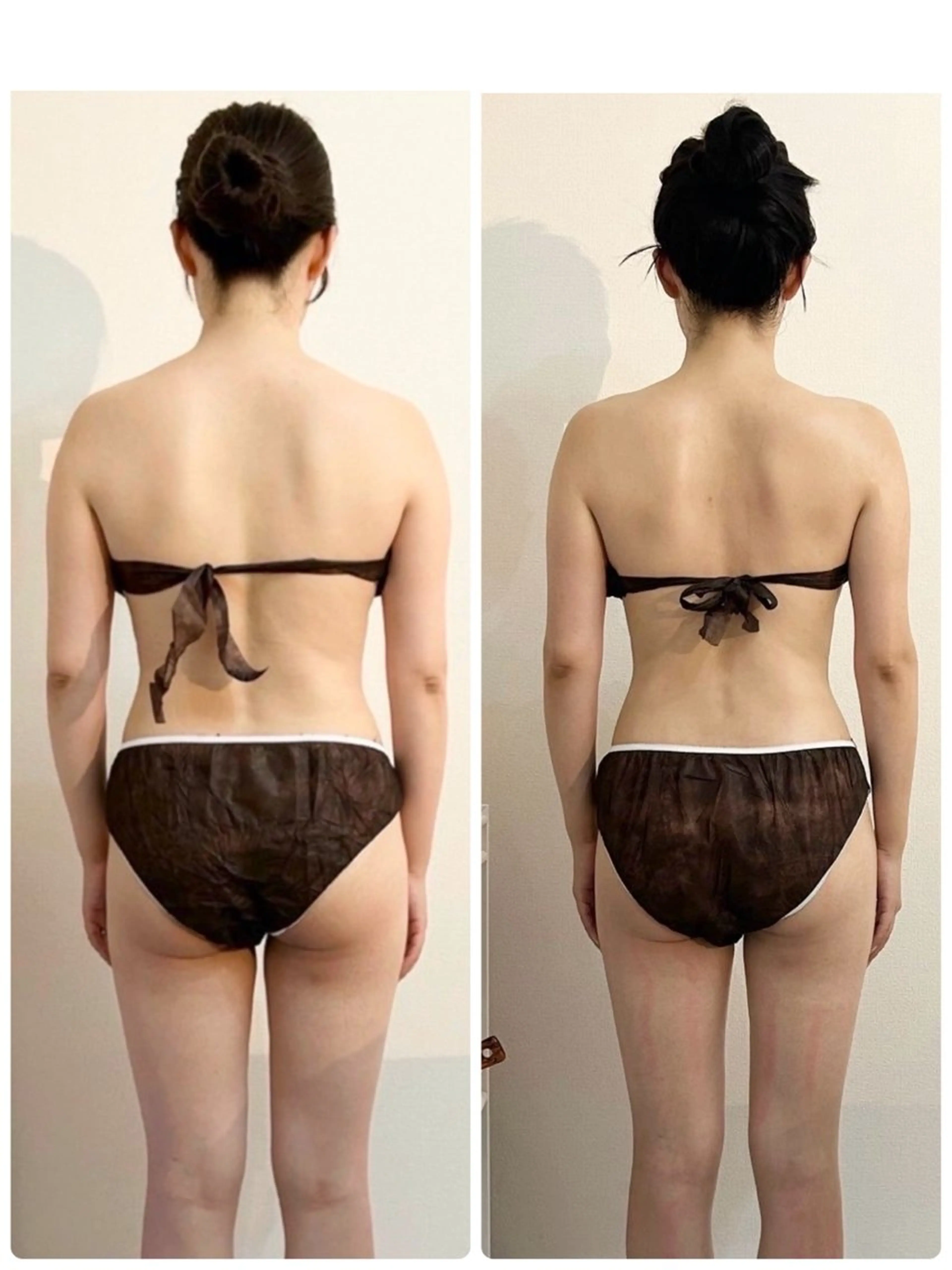 ハリつやUP！高級幹細胞導入！バストアップ×美脚の写真