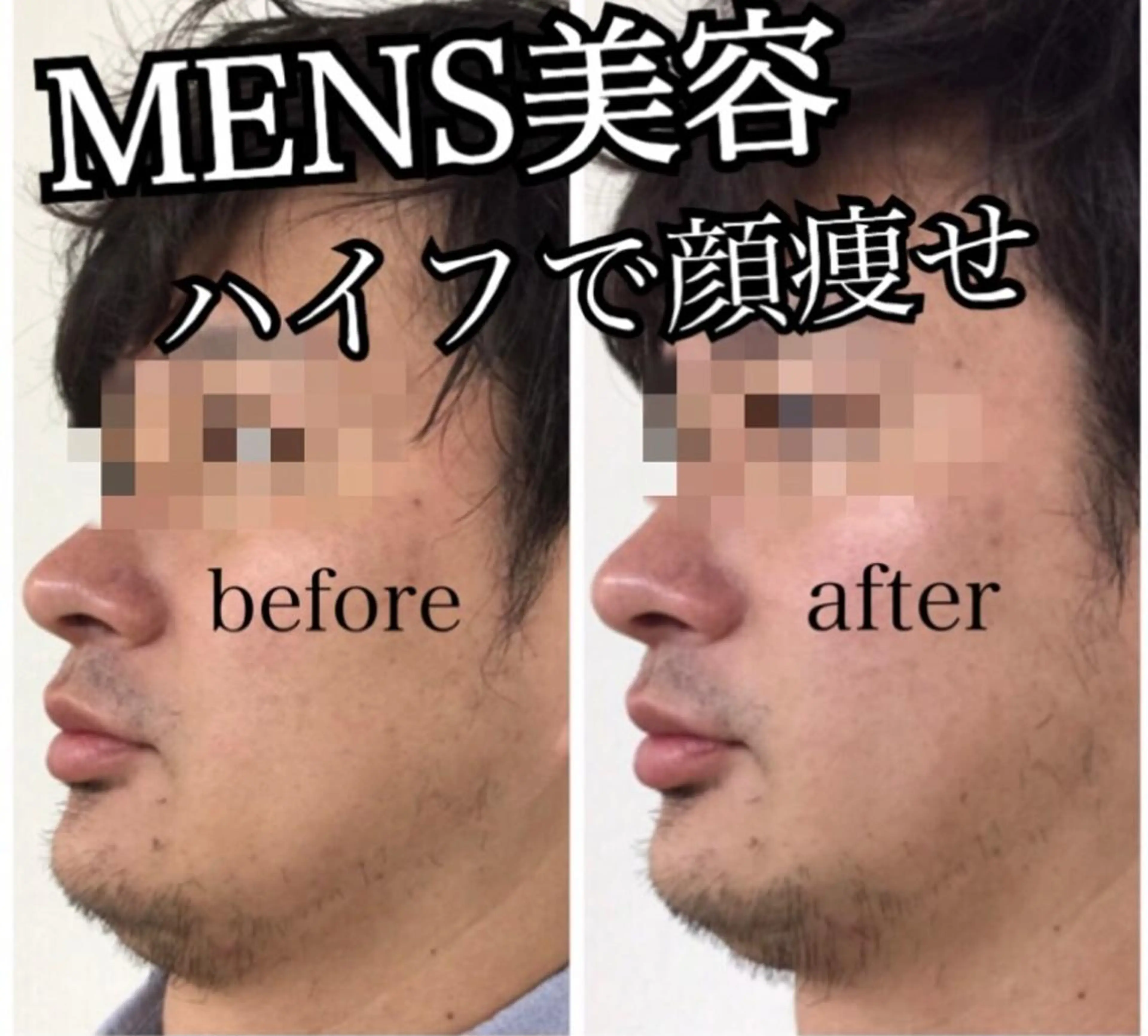 肌質改善サロン chouchouのエステ・リラクイメージ