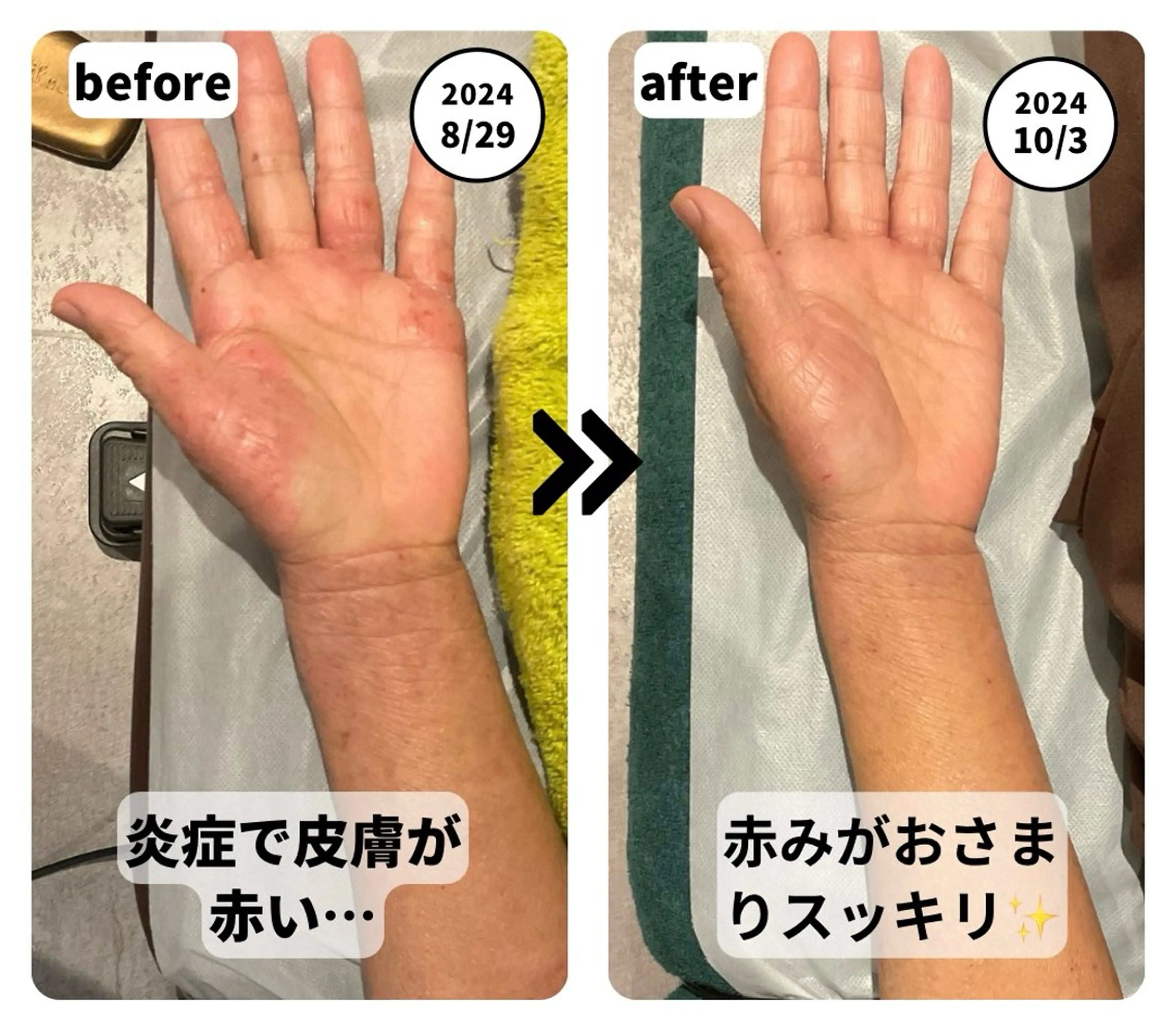 エステ リラク On接骨院 くまたのエステ・リラクイメージ