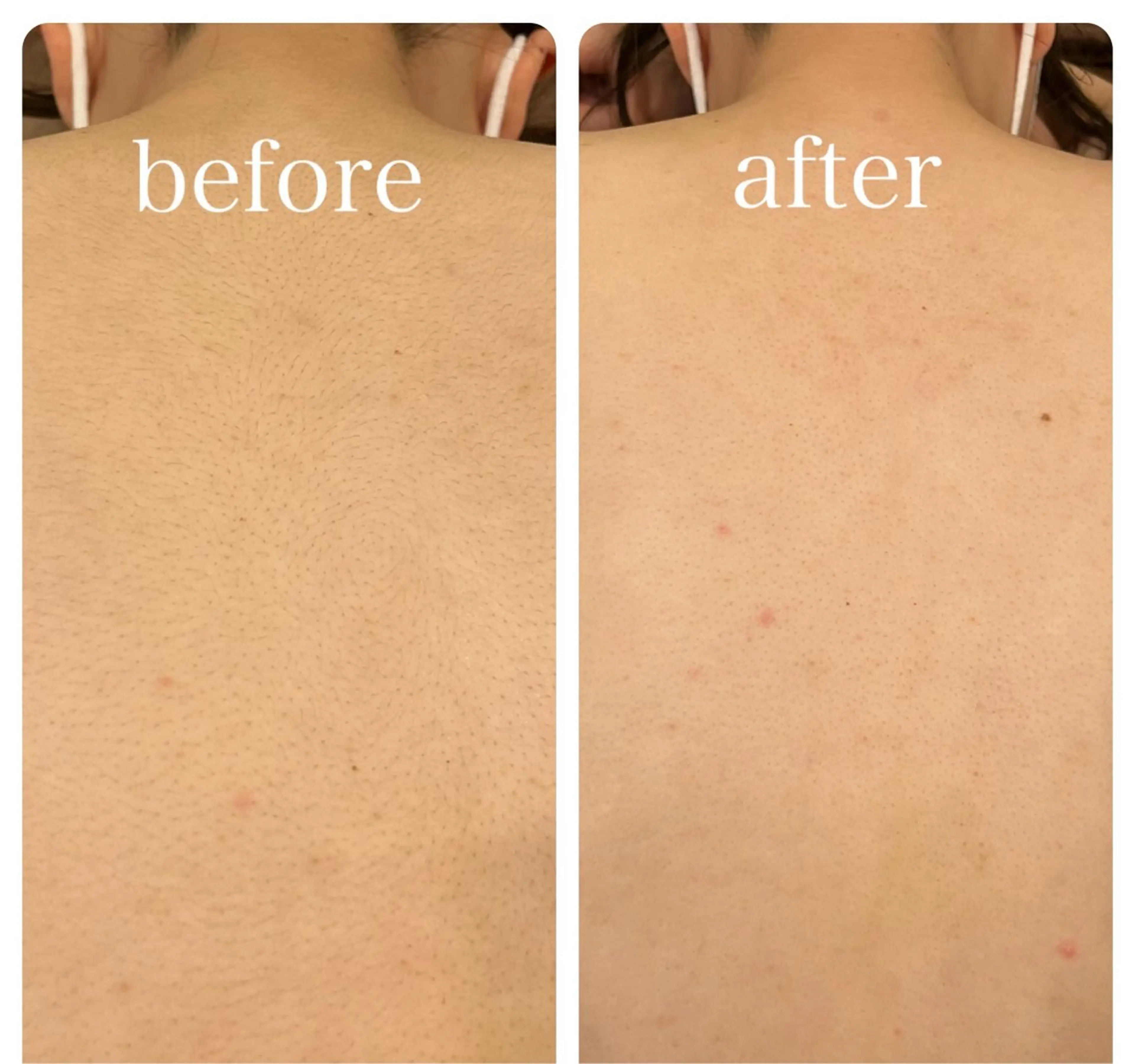 フェムケアサロン神戸 Elenear　なつのエステ・リラクイメージ