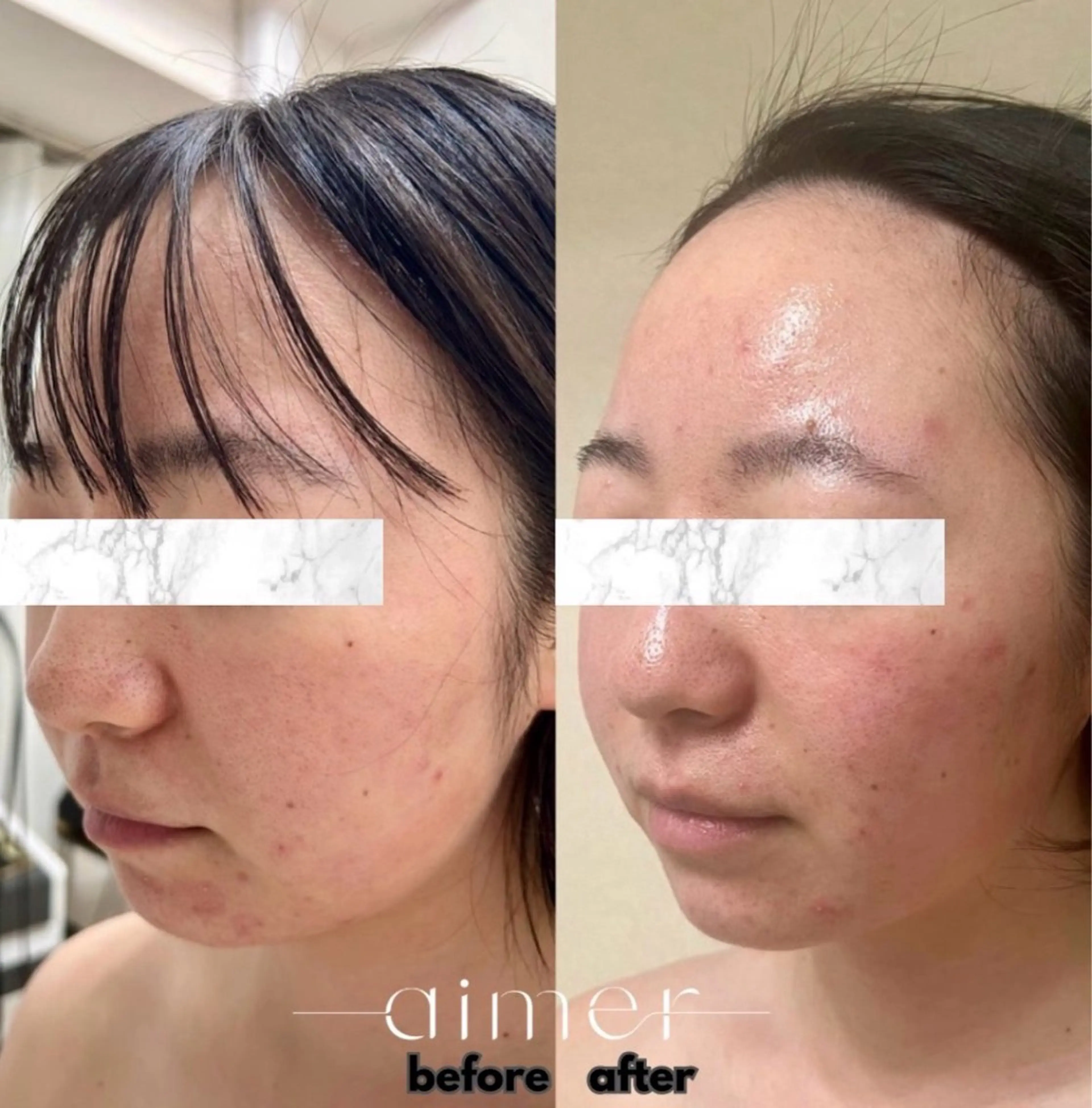 aimer 島田のエステ・リラクイメージ