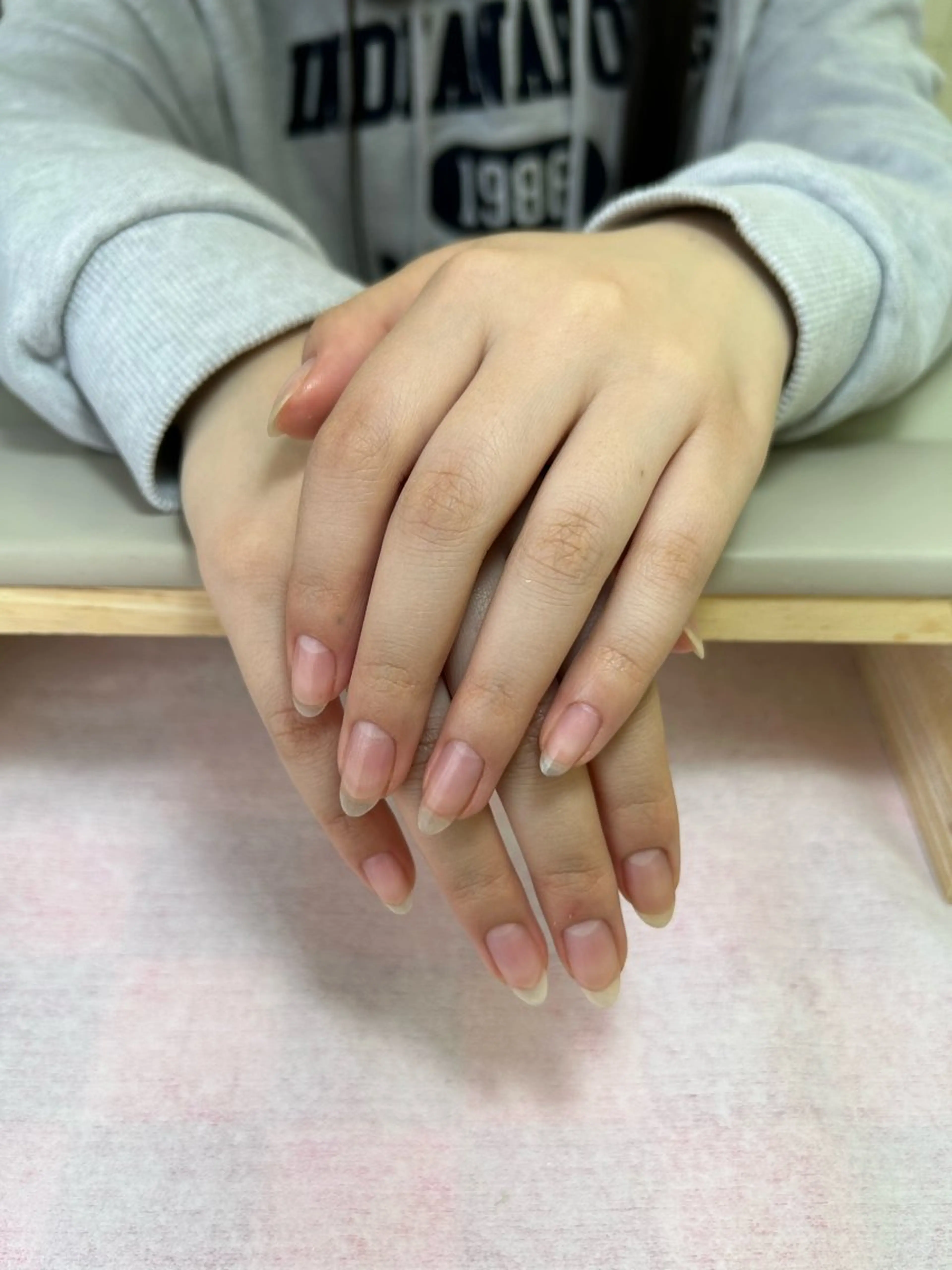 🌱チップorスカルプオフの写真