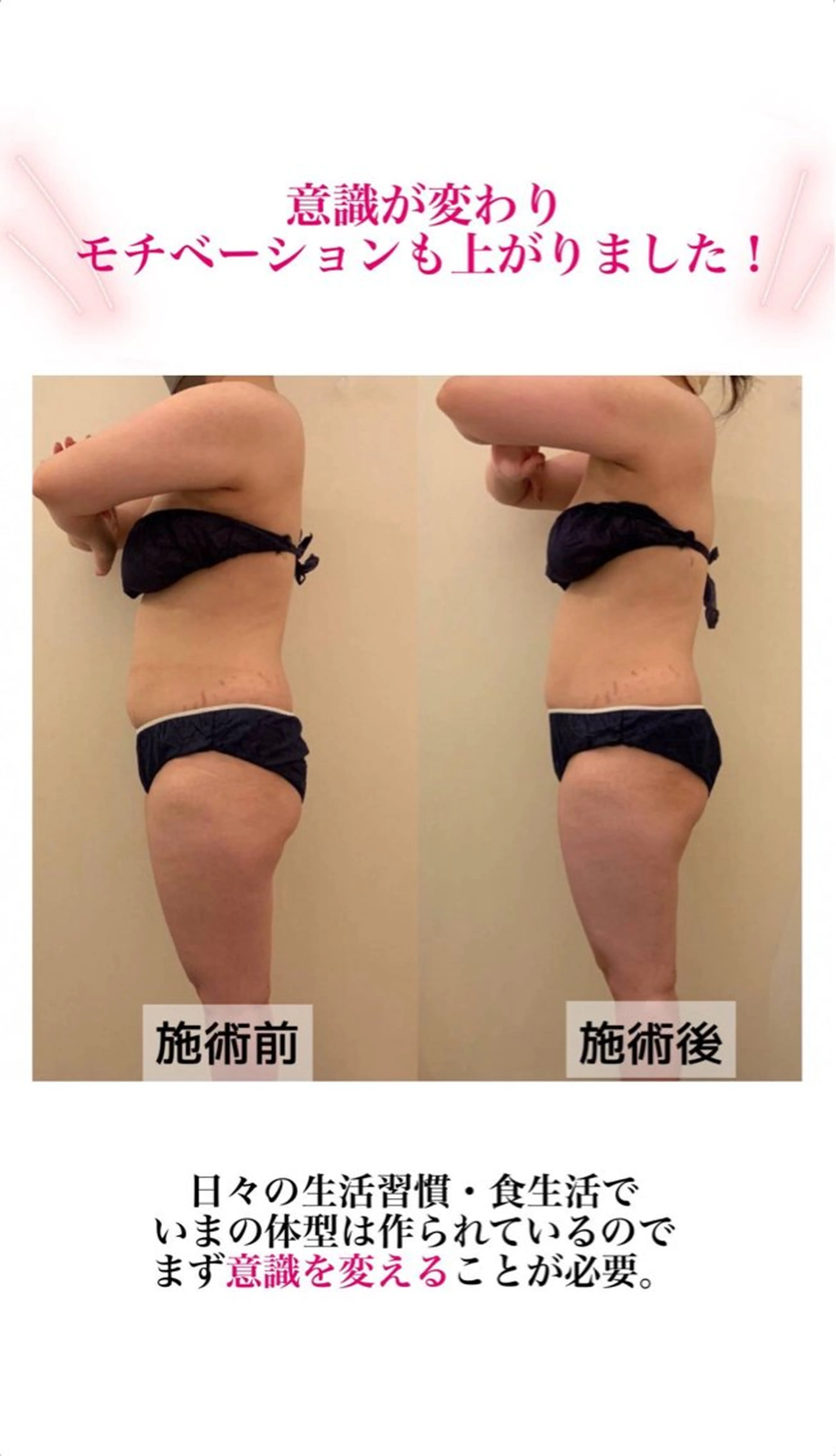 産後ダイエット−9㎏ Pourvous結衣のエステ・リラクイメージ