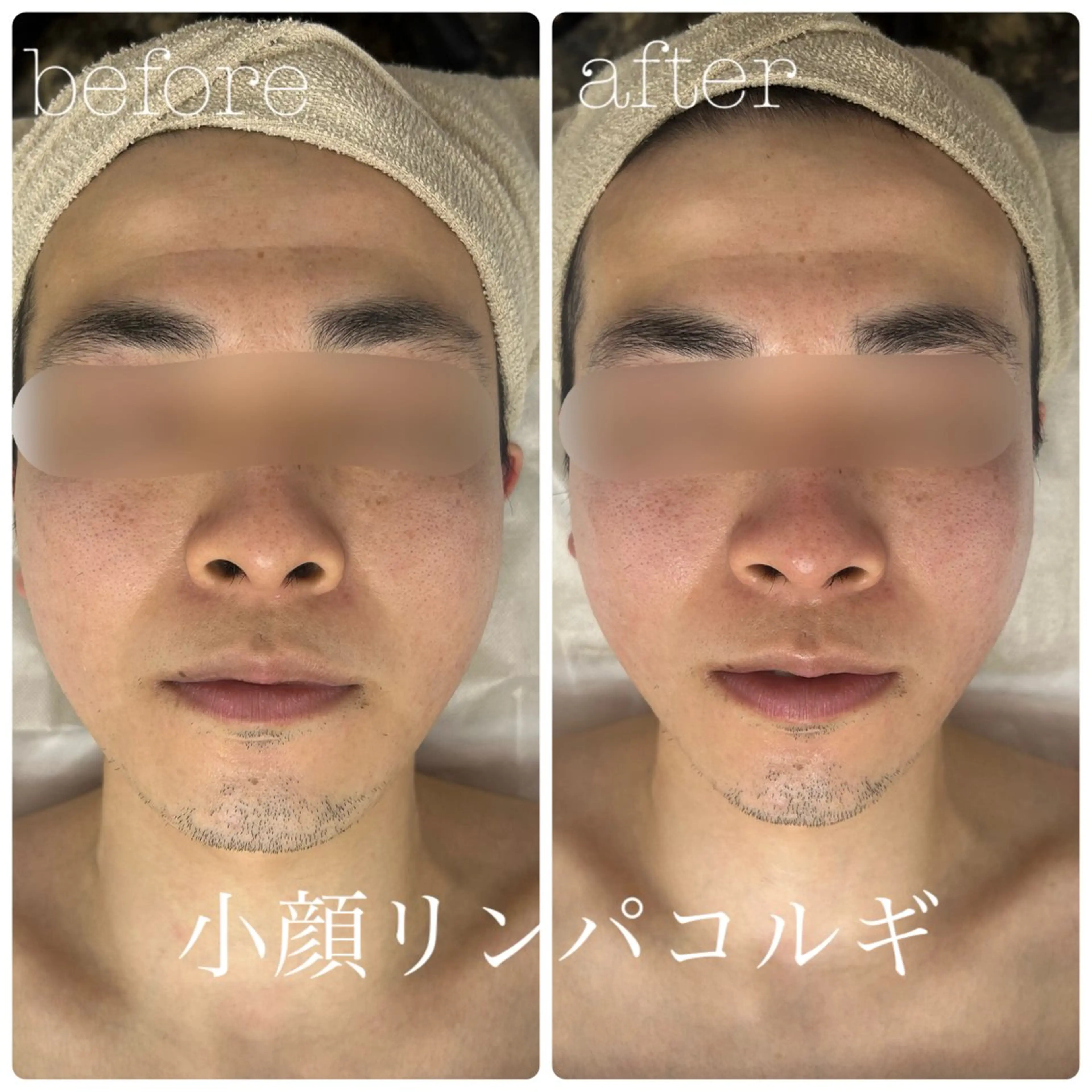 メンズ フェイシャルサロン CHIARA 荒田のエステ・リラクイメージ