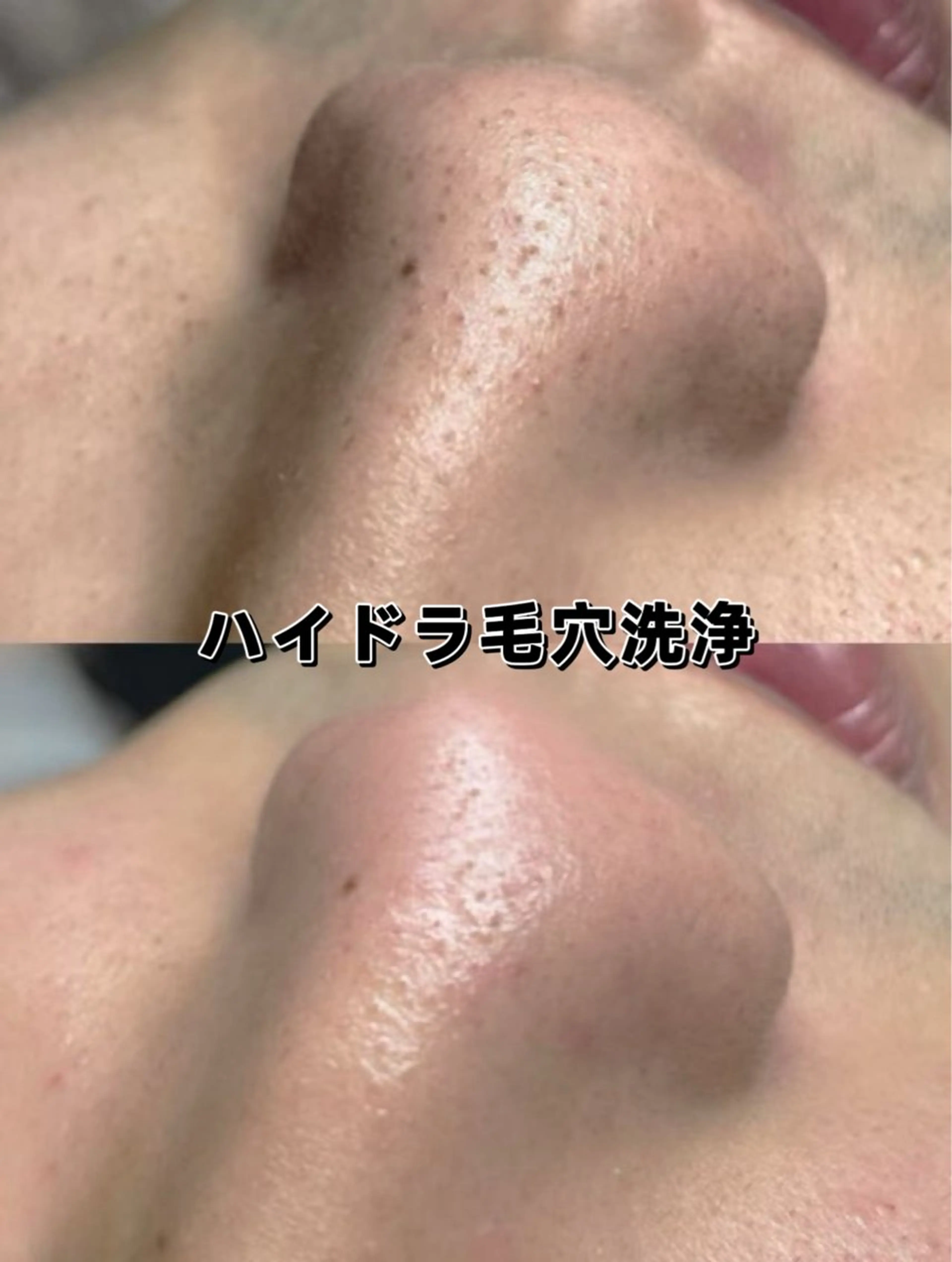 美BELLO 池袋のエステ・リラクイメージ