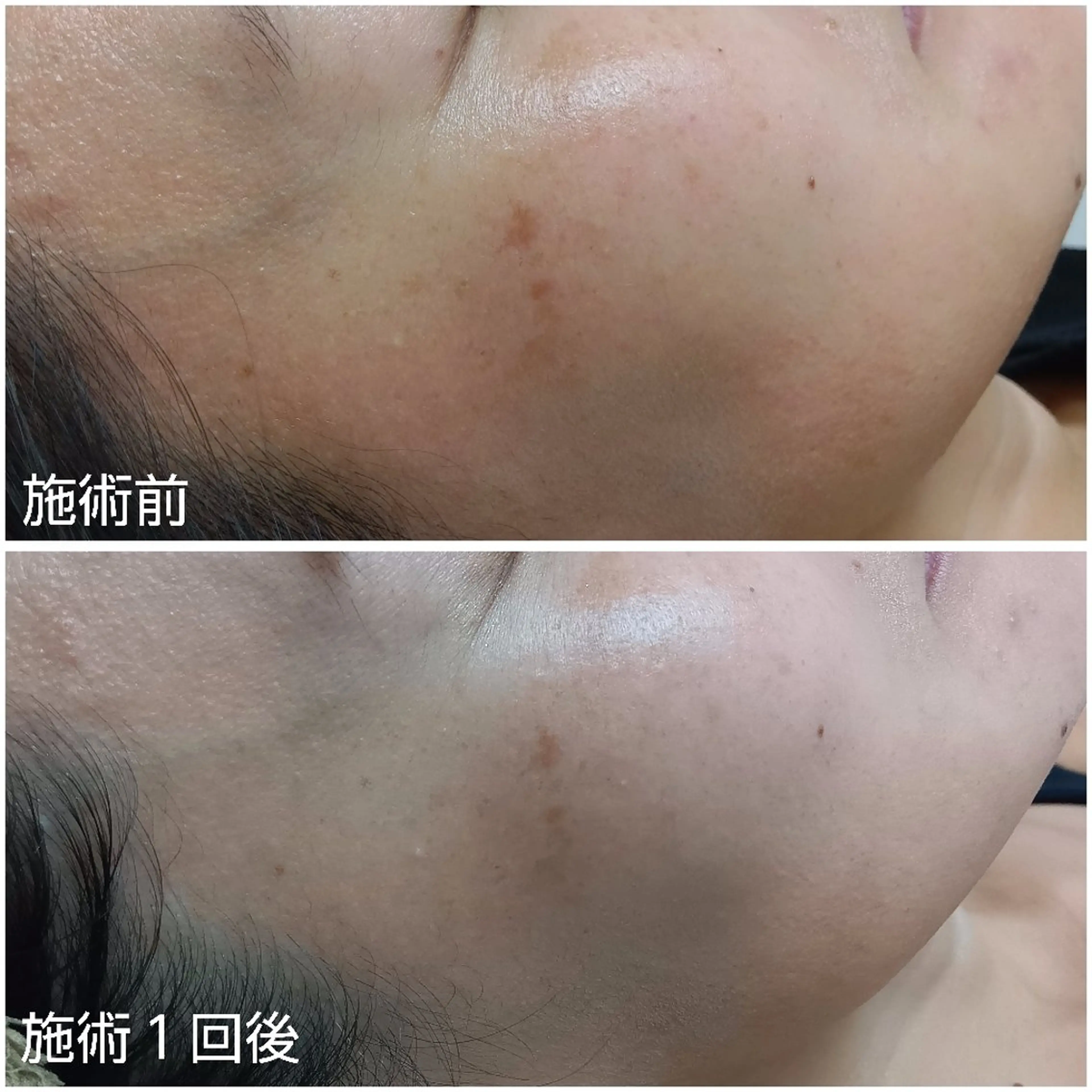 シミケア専門店 HAQUAのエステ・リラクイメージ