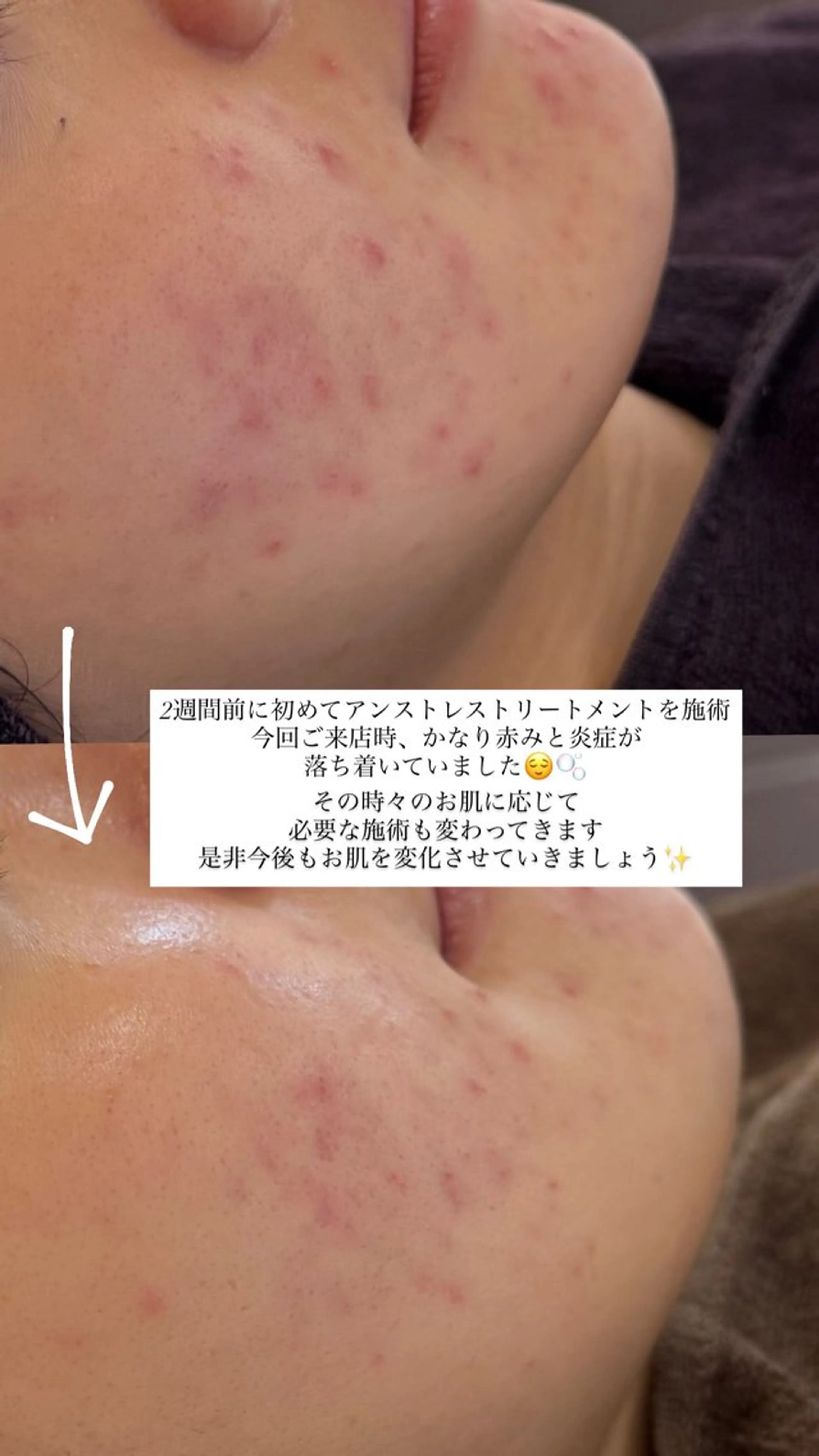 エステ yukiko/美容師 肌質改善/中崎町のエステ・リラクイメージ