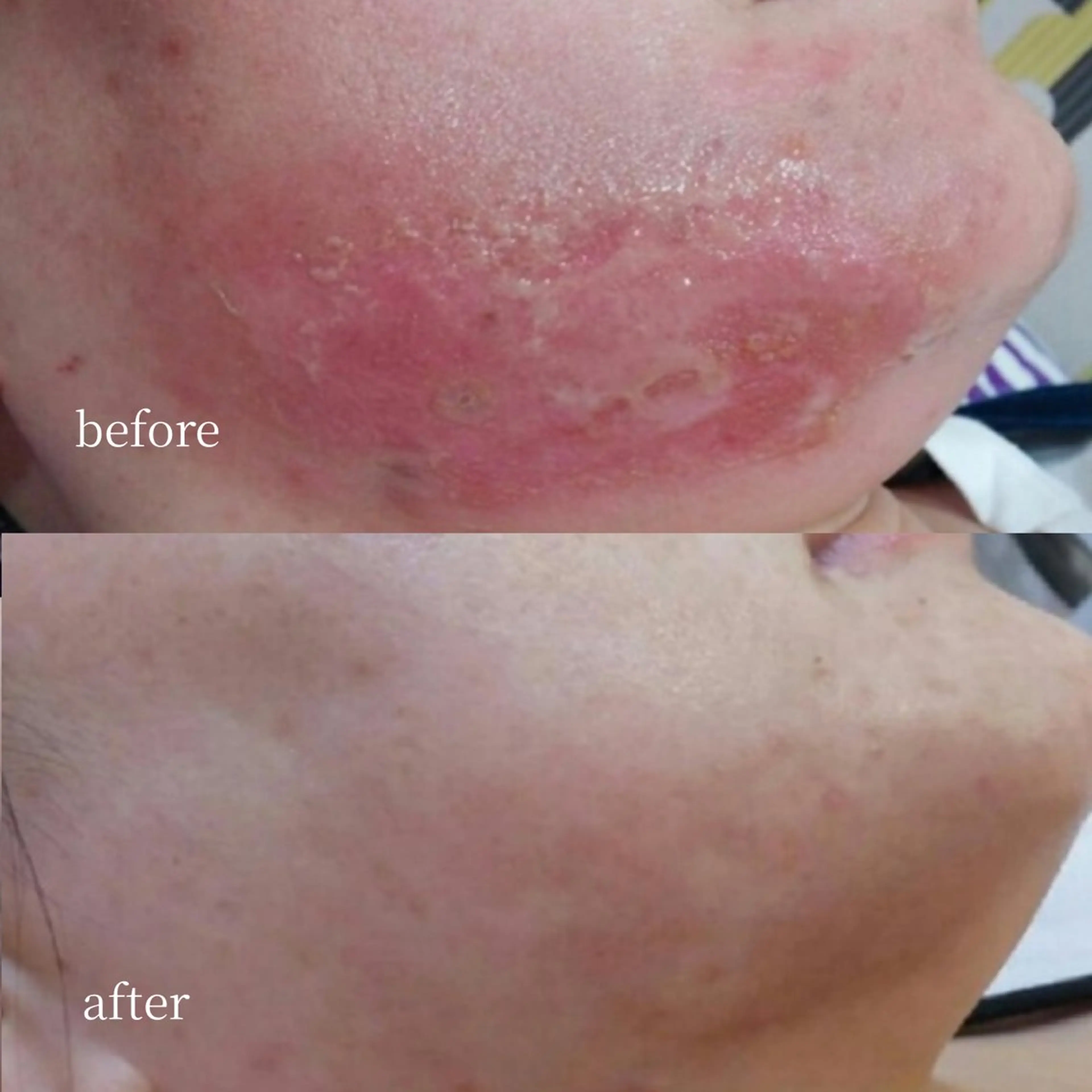 韓国肌管理・肌質改善 EARNEST心斎橋のエステ・リラクイメージ