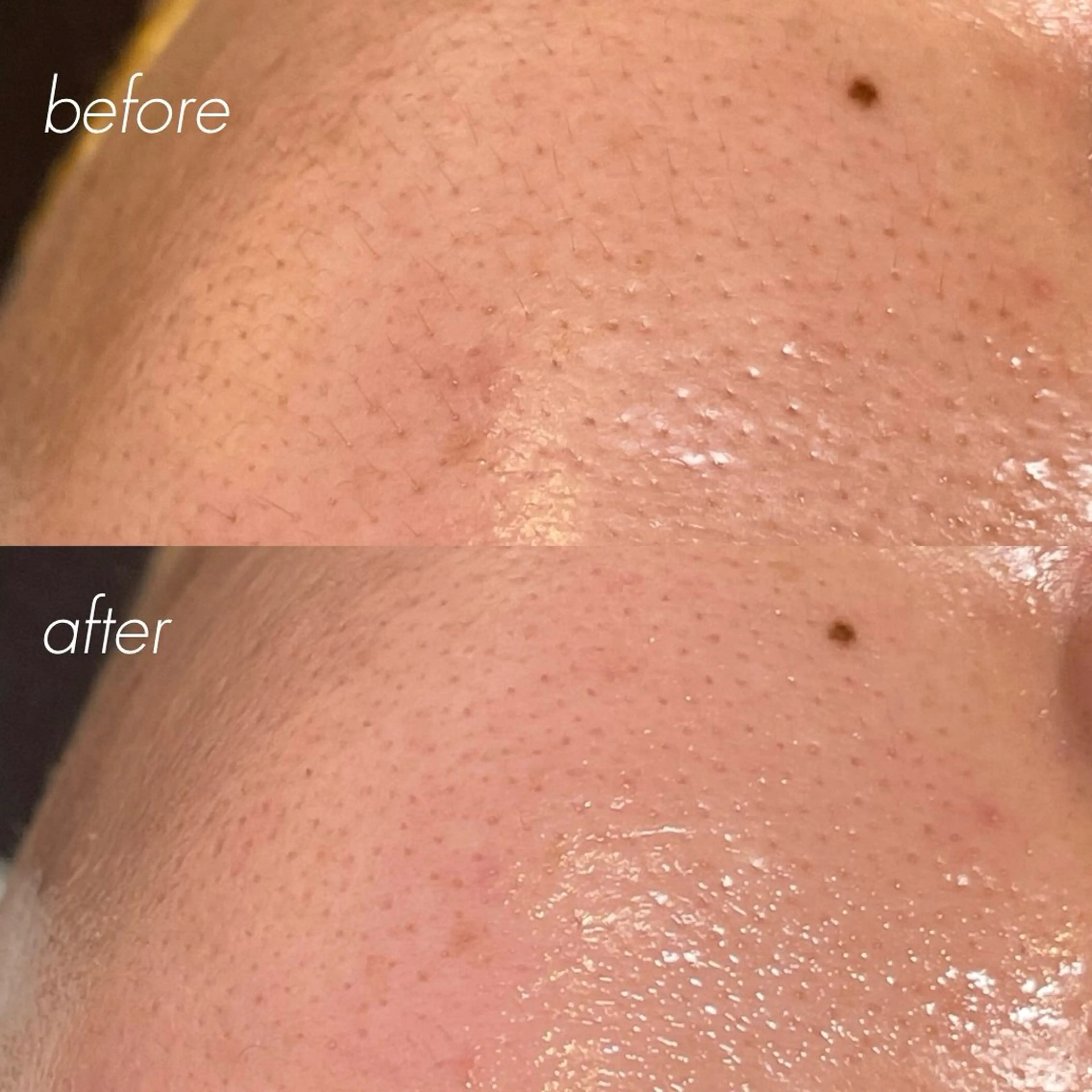 【WAX✨】全顔/鎮静高保湿パック付きの写真