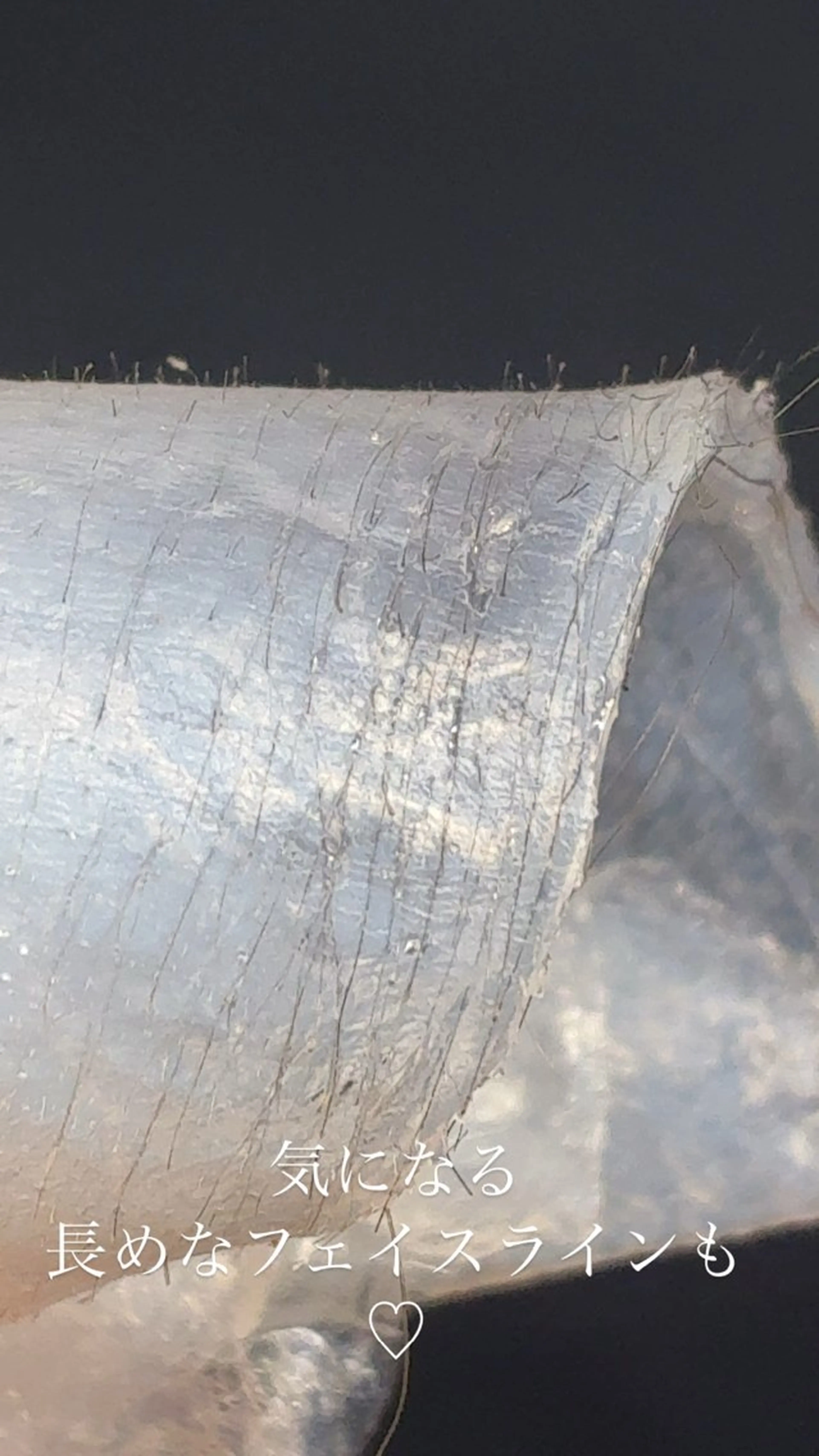 脱毛 産毛専門店 Bittoのエステ・リラクイメージ