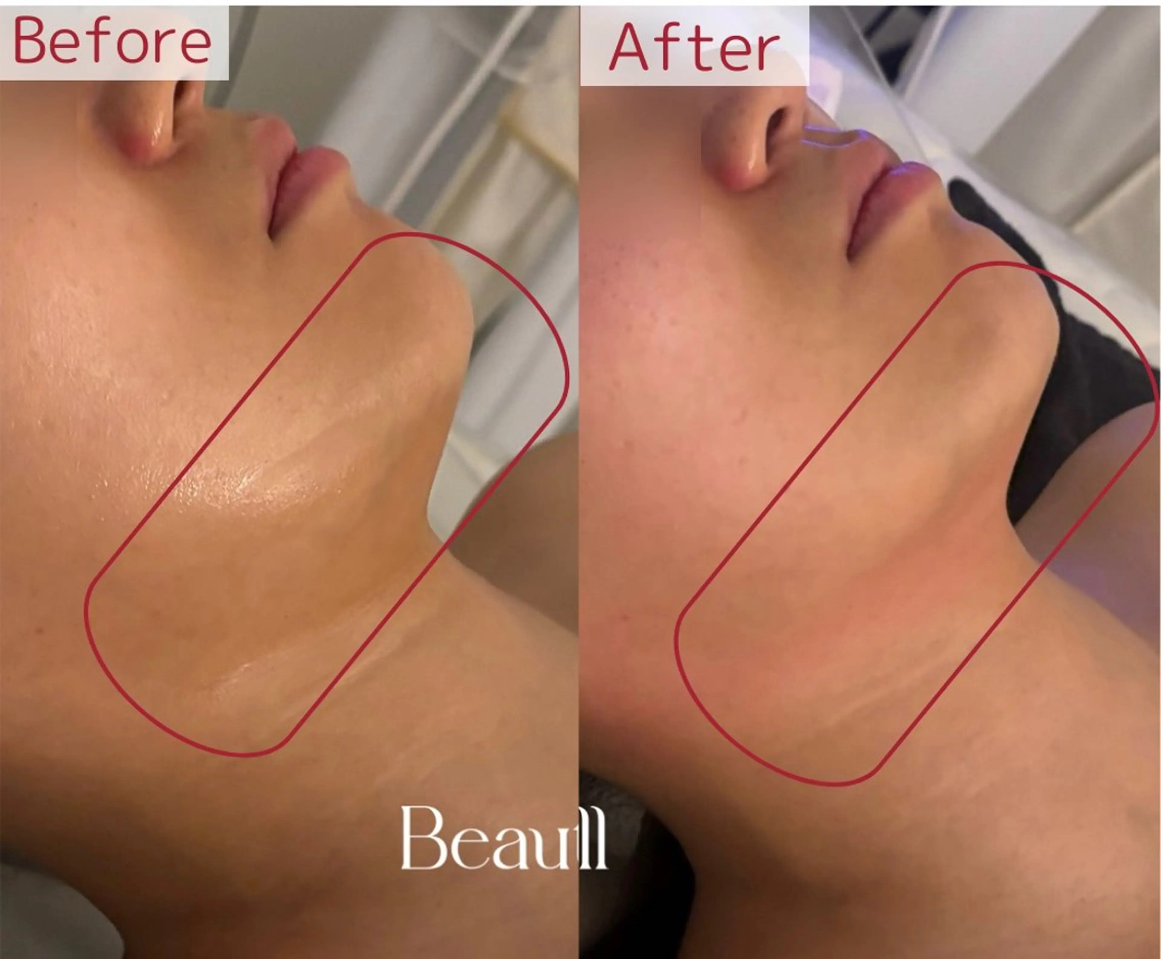 lumirise所属・lumi riseのエステ・リラクイメージ