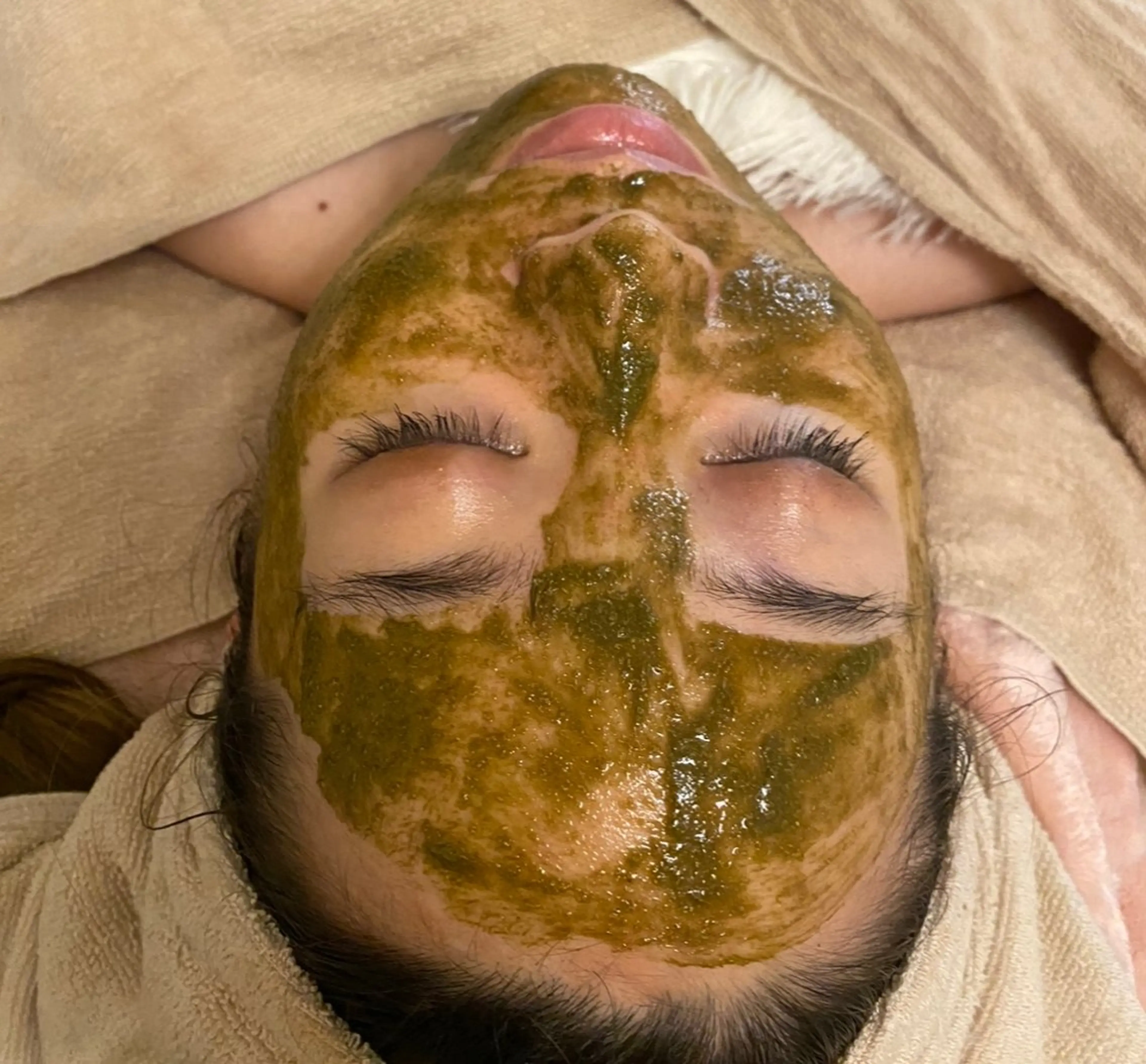 ⭐️毛穴洗浄&美容液導入ハーブピーリング🌿の写真