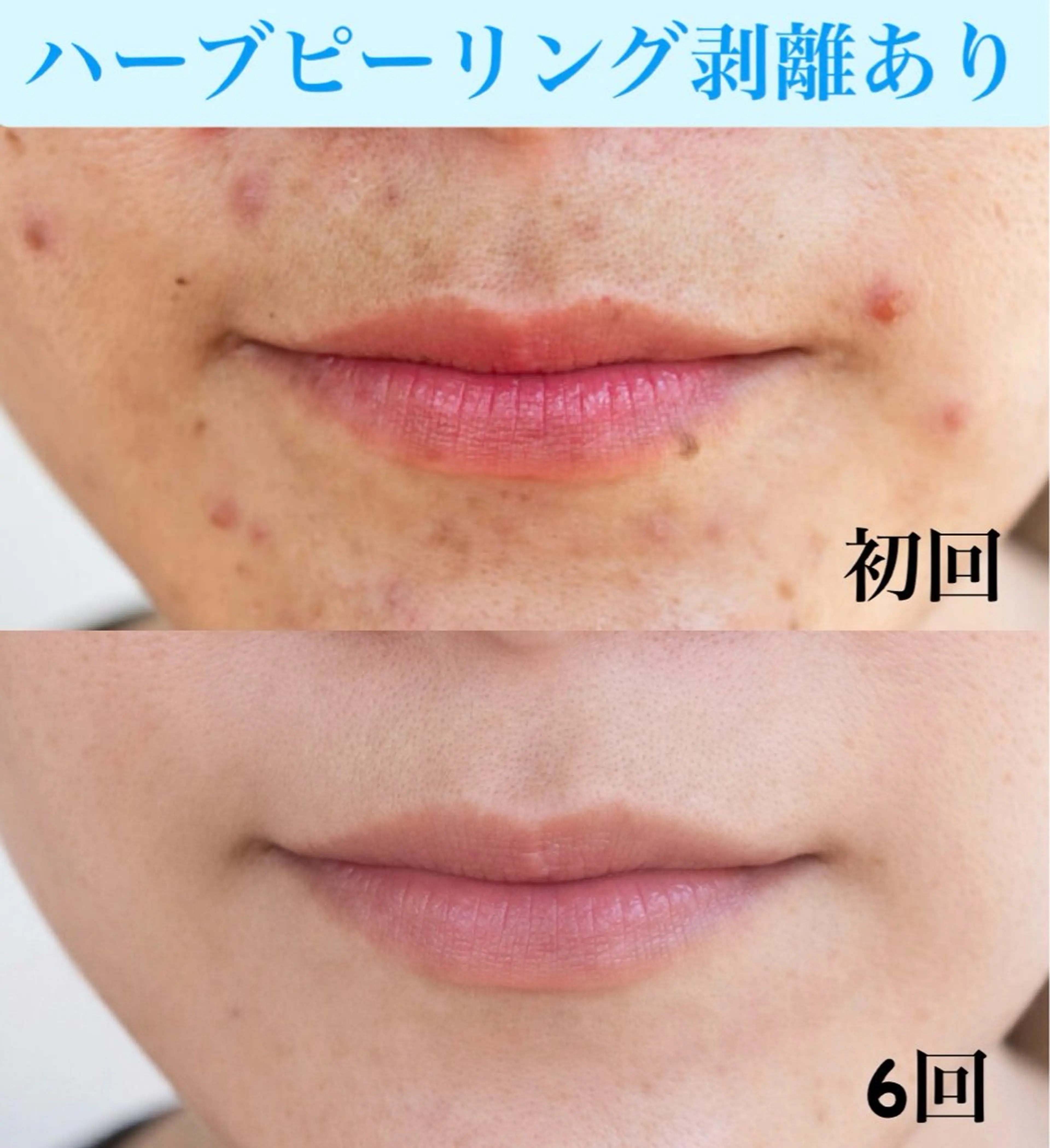 エステ Soin 身体＆お肌ケアのエステ・リラクイメージ