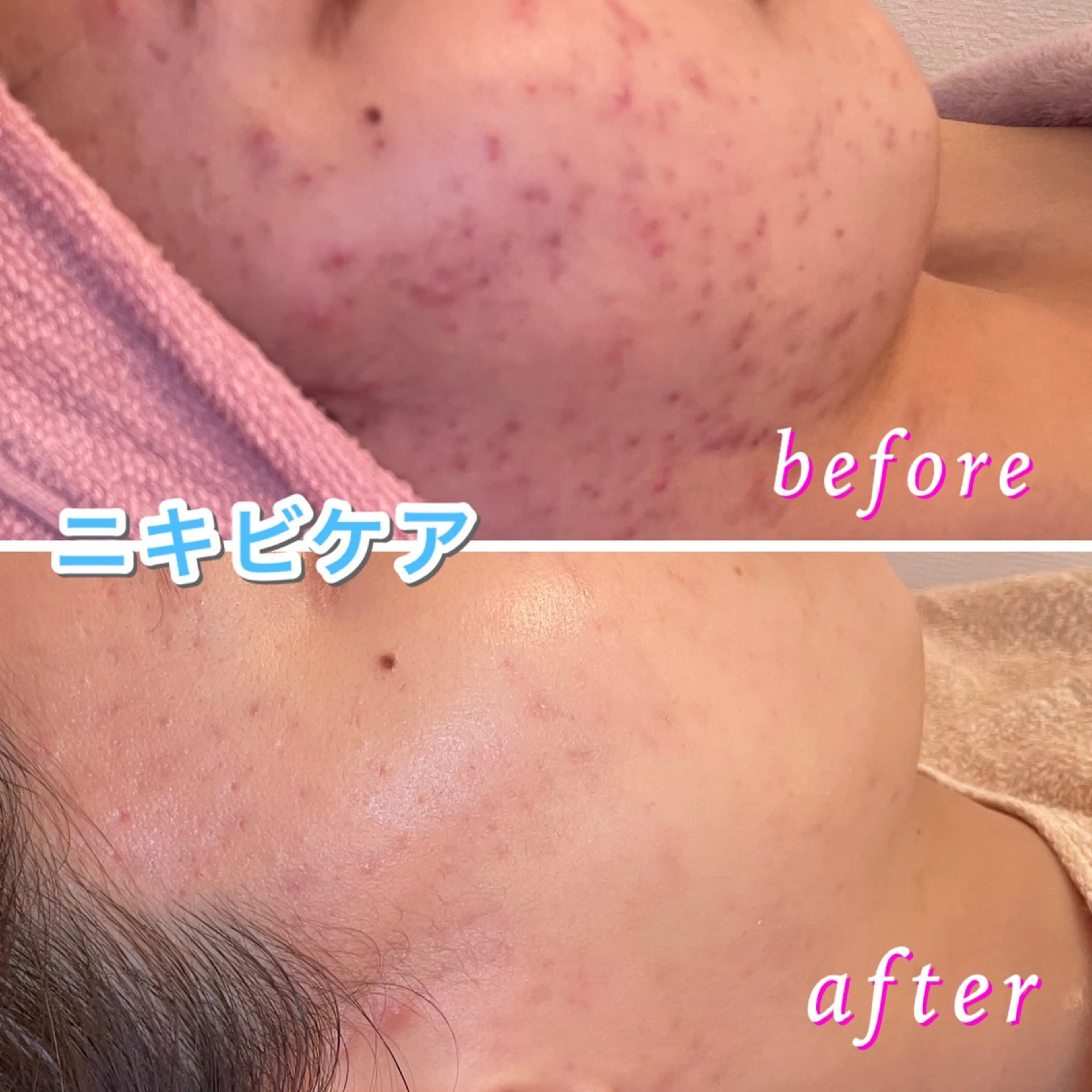 3glitter 肌質改善＆痩身のエステ・リラクイメージ