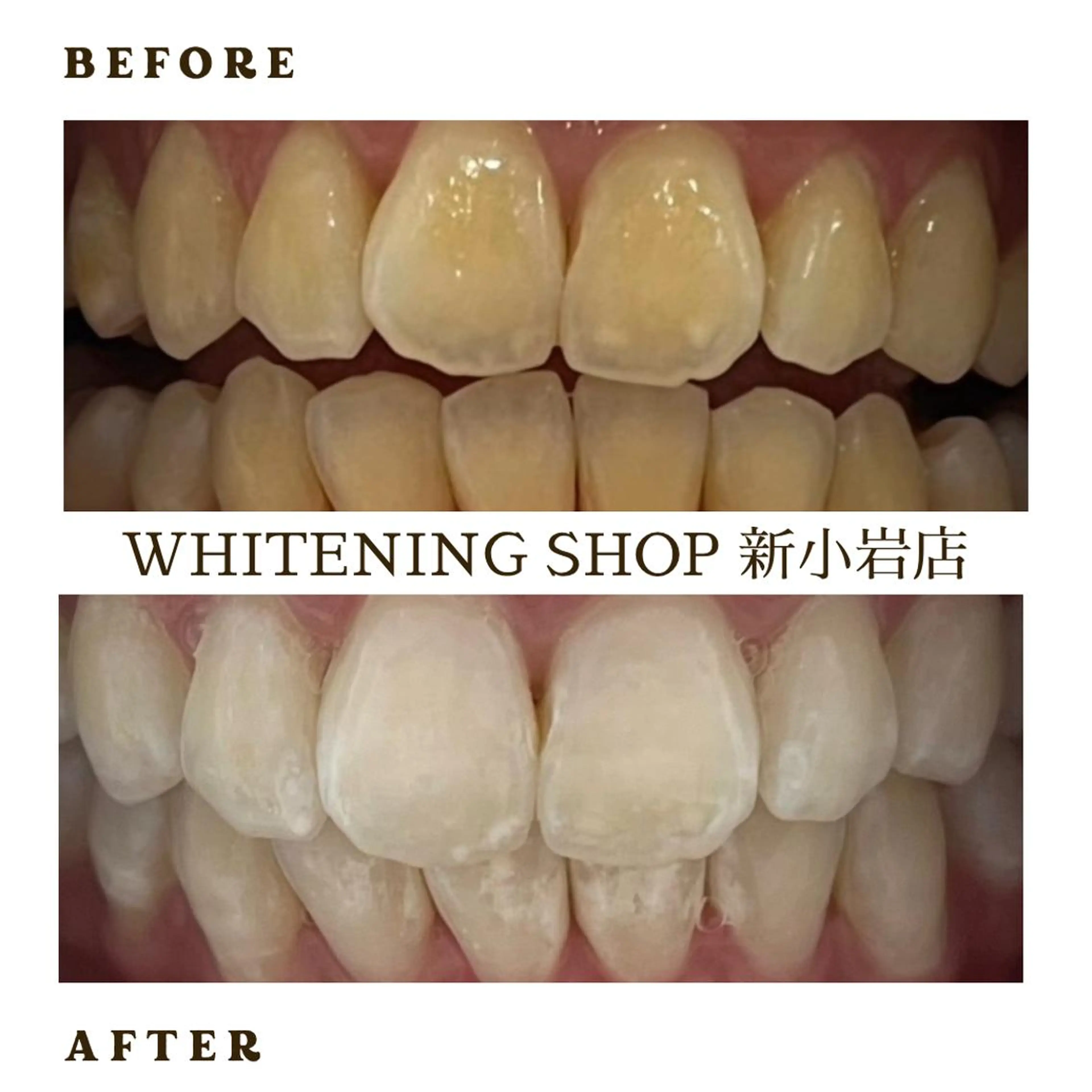 メンズ その他 ホワイトニング ショップ新小岩店のその他イメージ