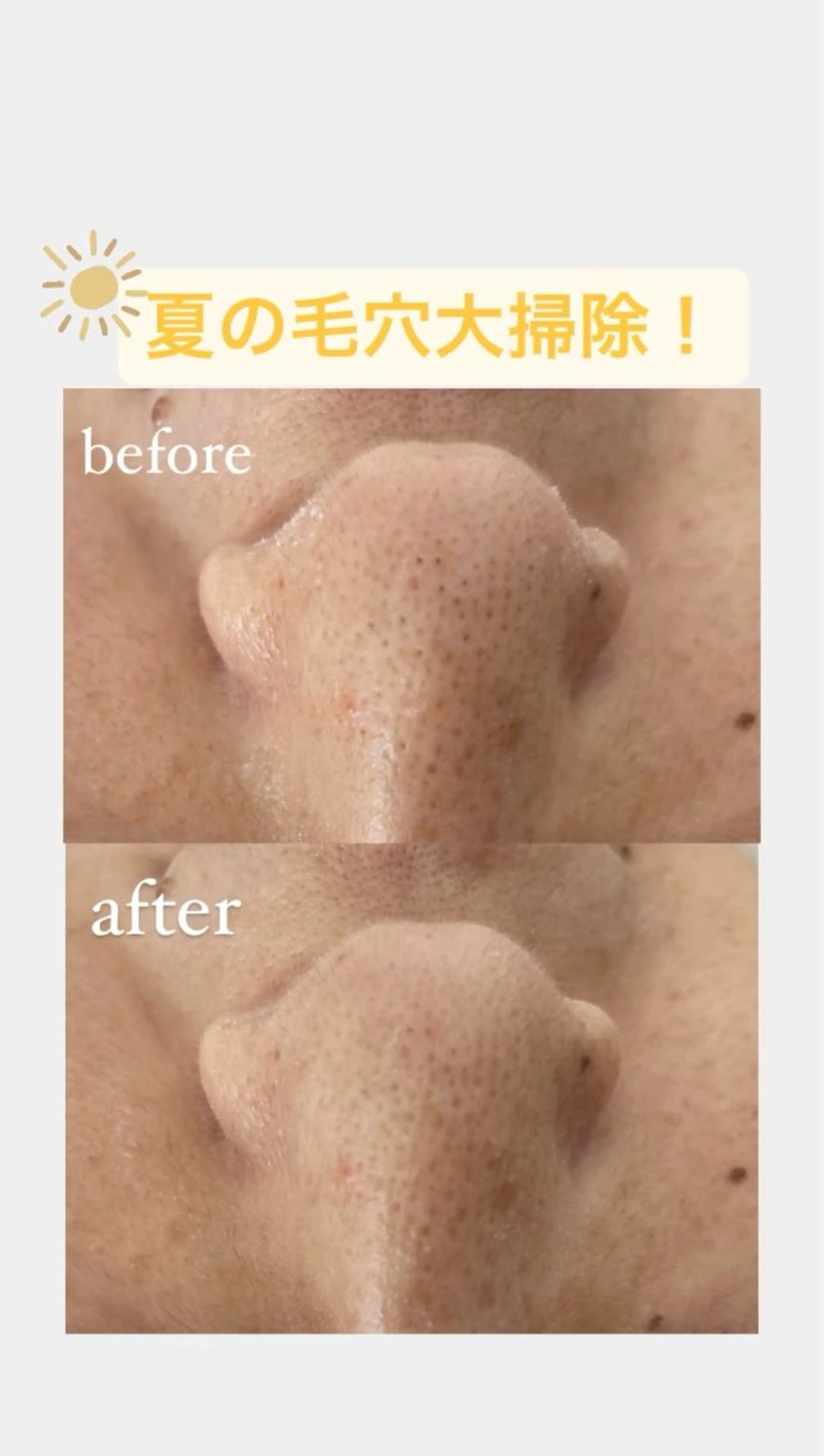 CSサロン Amule所属・Amule anna🦋のエステ・リラクイメージ