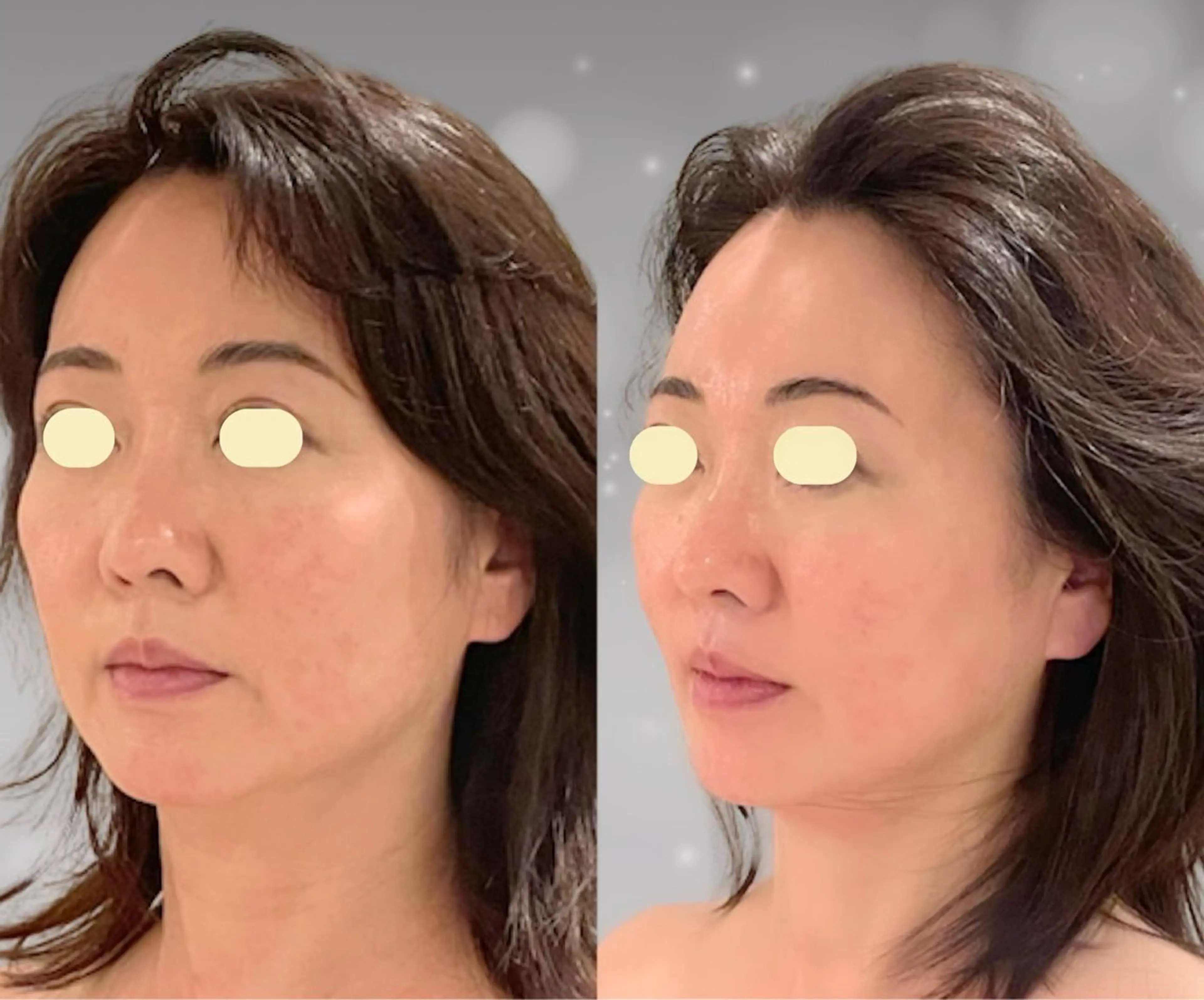 エステ 【小顔痩身専門看護師 サロンSONA】のエステ・リラクイメージ