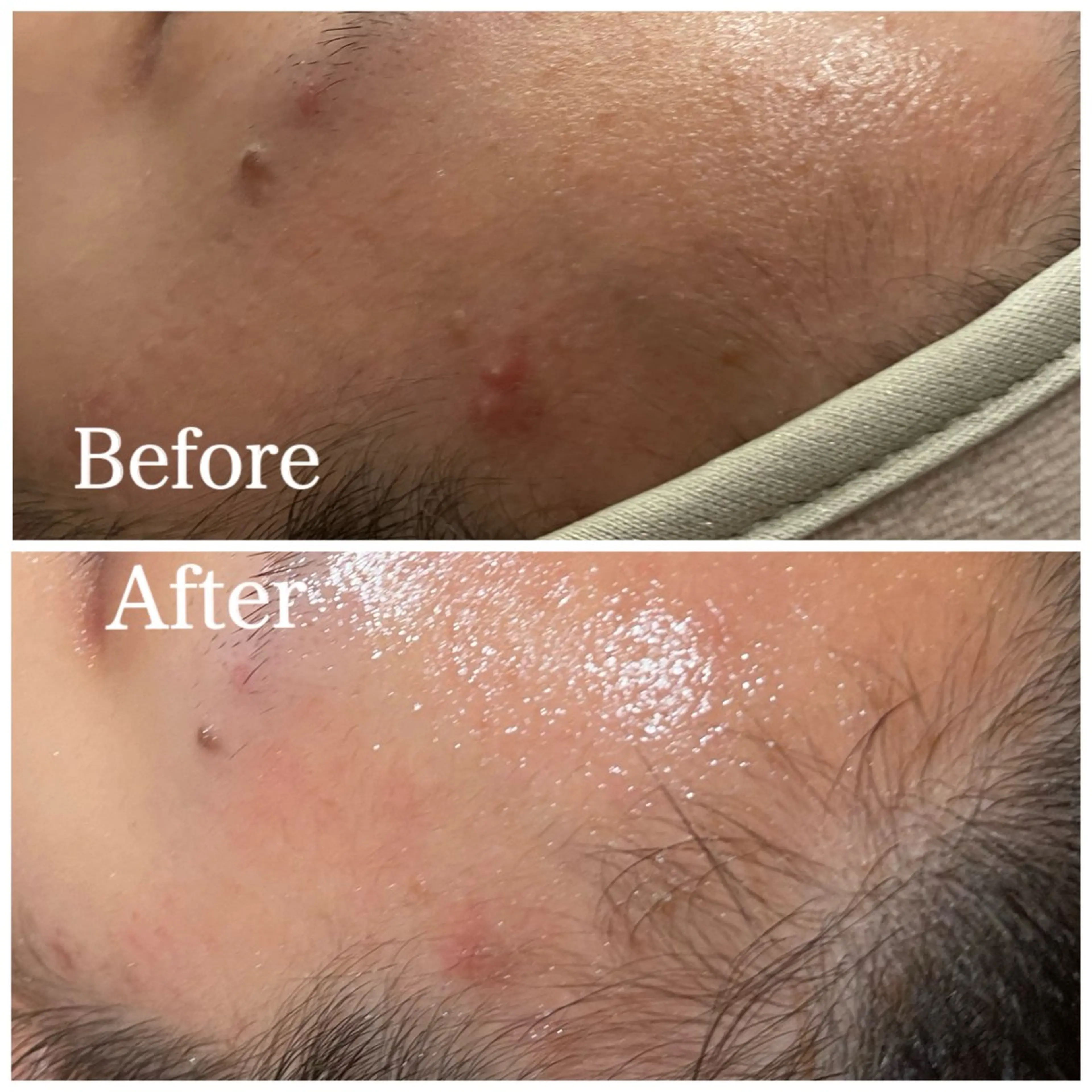 Nna 韓国肌管理のエステ・リラクイメージ