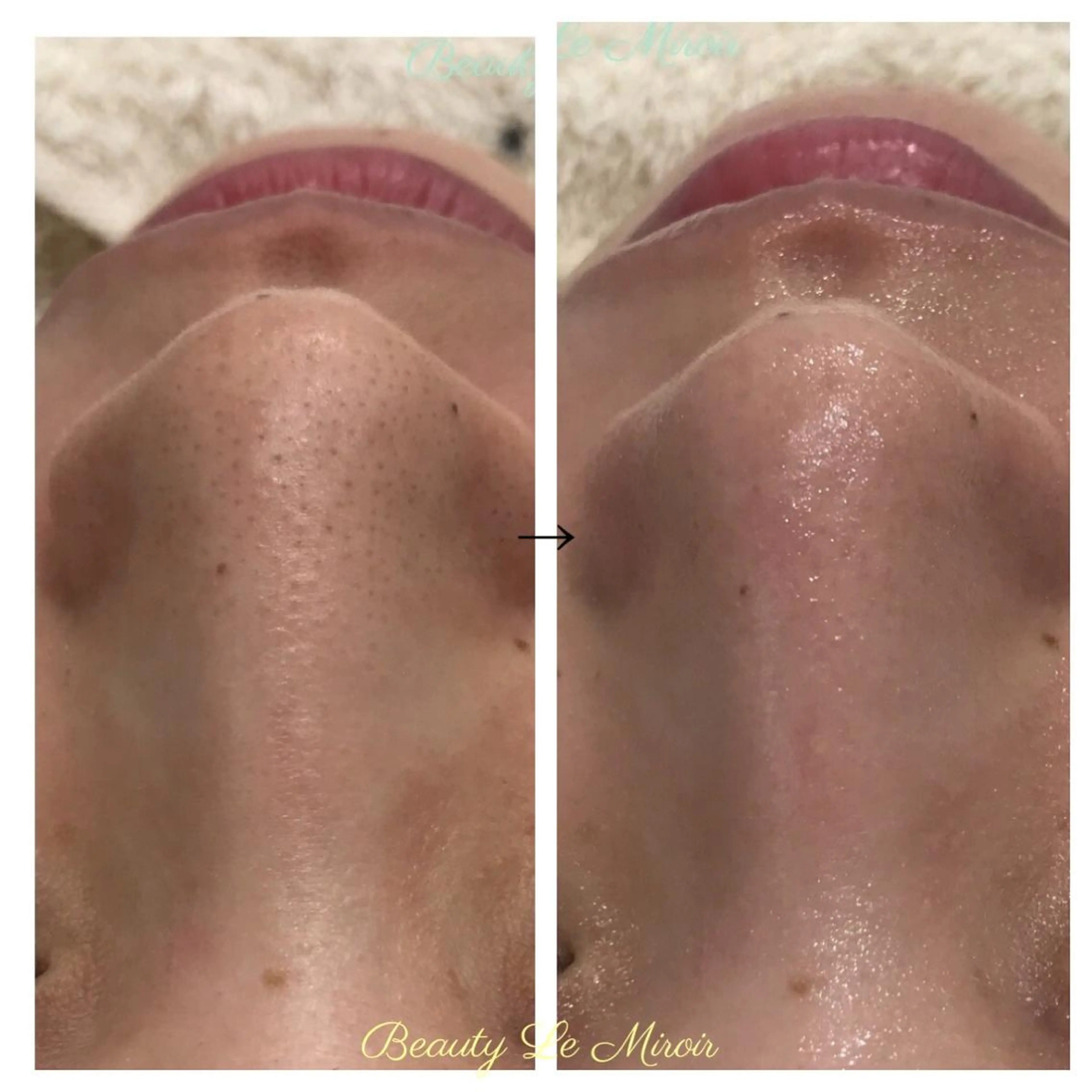 ビューティー ミロワールのエステ・リラクイメージ