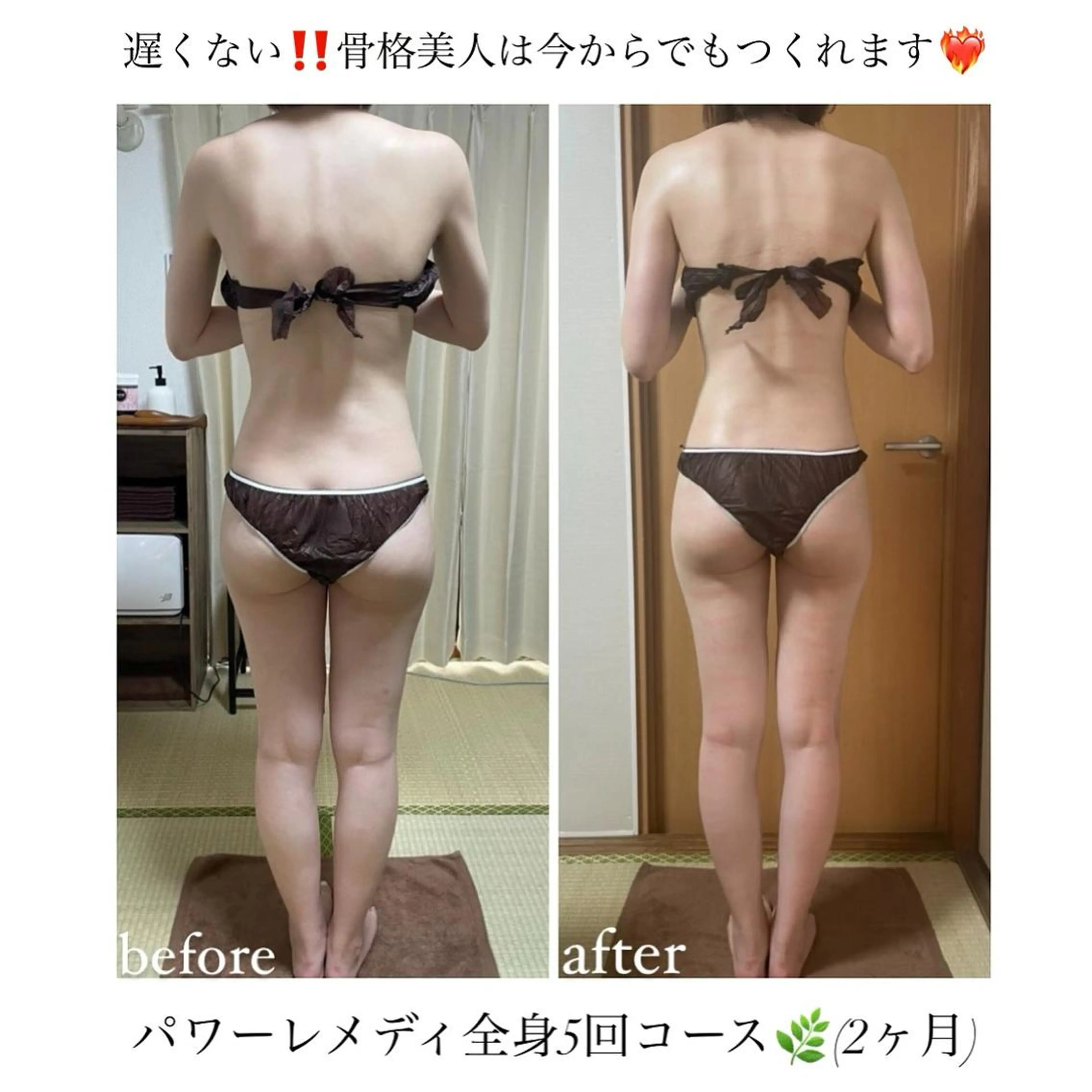 《本気痩せ×疲労改善 》  BILOOPのエステ・リラクイメージ