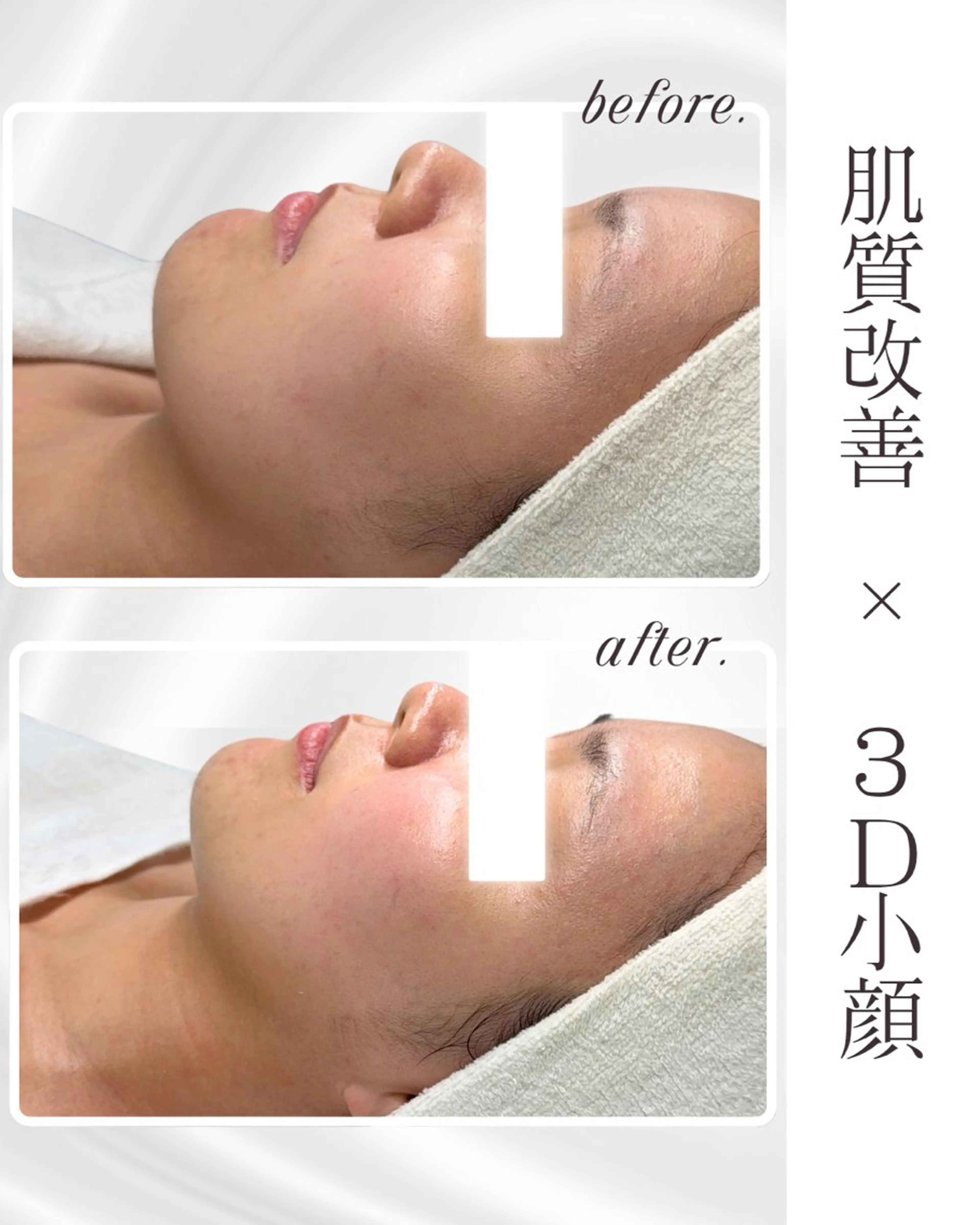 LiAm《美肌管理/ 小顔/脂肪ケア》のその他イメージ