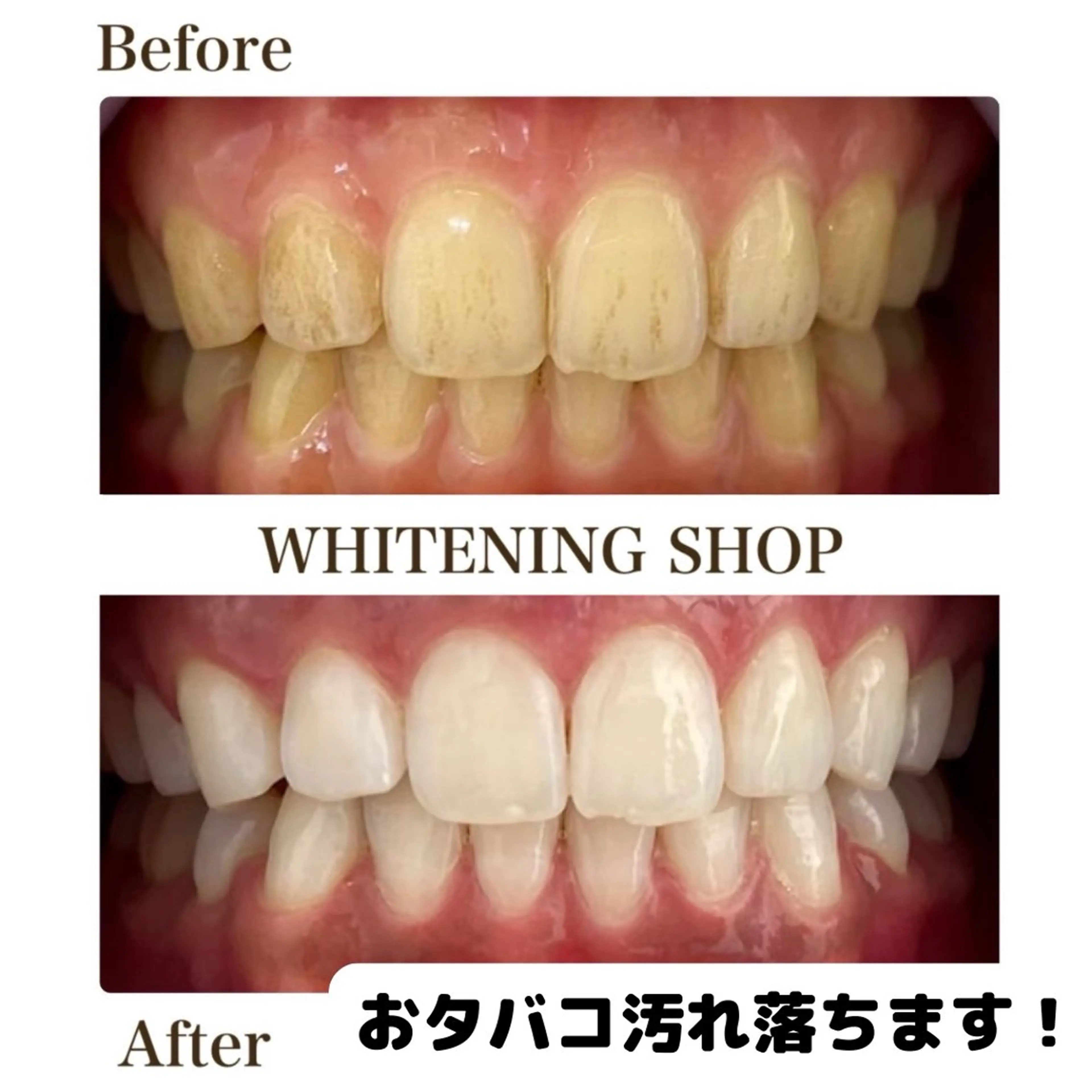 メンズ キッズ ホワイトニング ショップ多摩店のその他イメージ