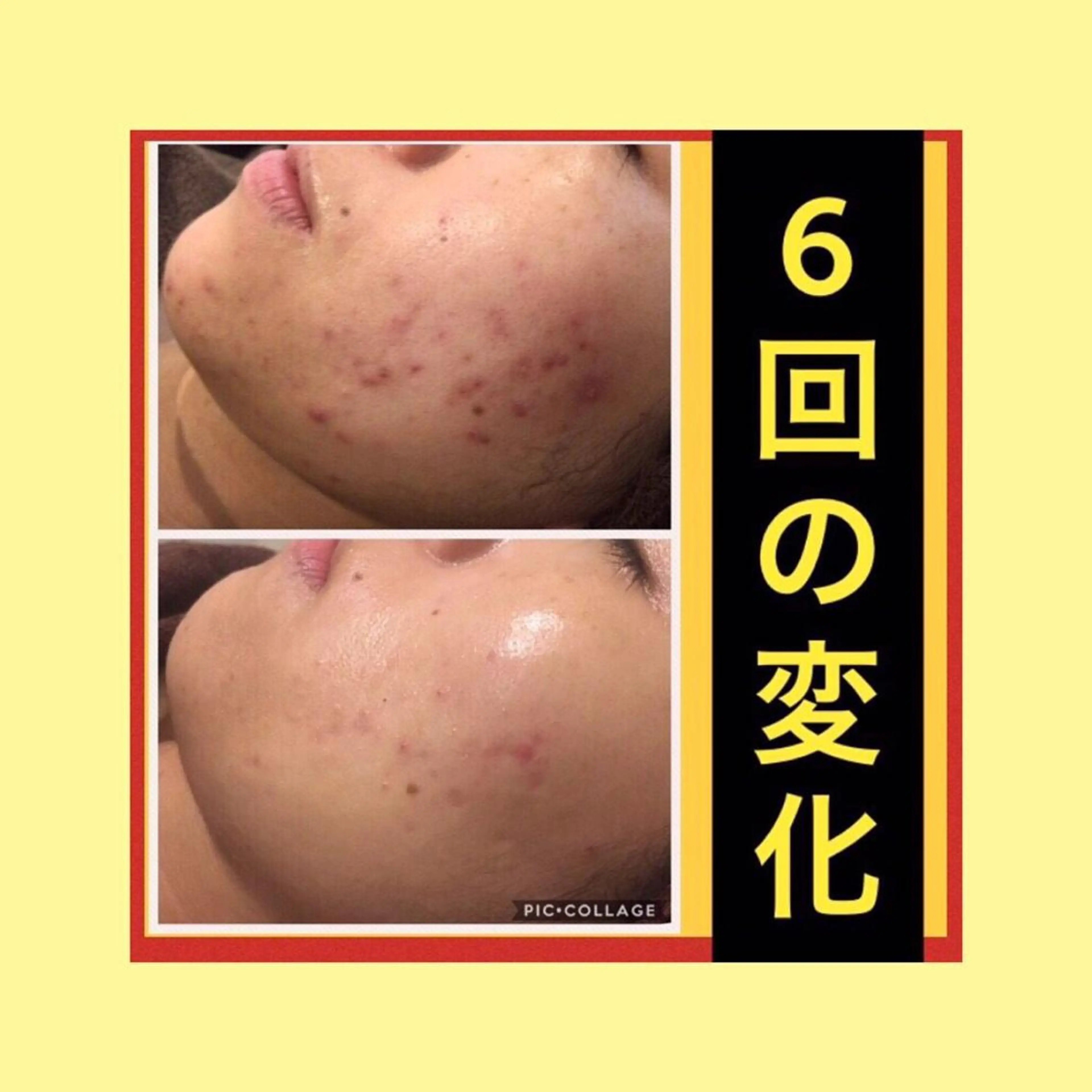 ミディアム パーマ ヘアアレンジ メンズ キッズ ネイル マツエク・マツパ ニキビ・肌質改善専門 ♡人生が変わるサロンのエステ・リラクイメージ