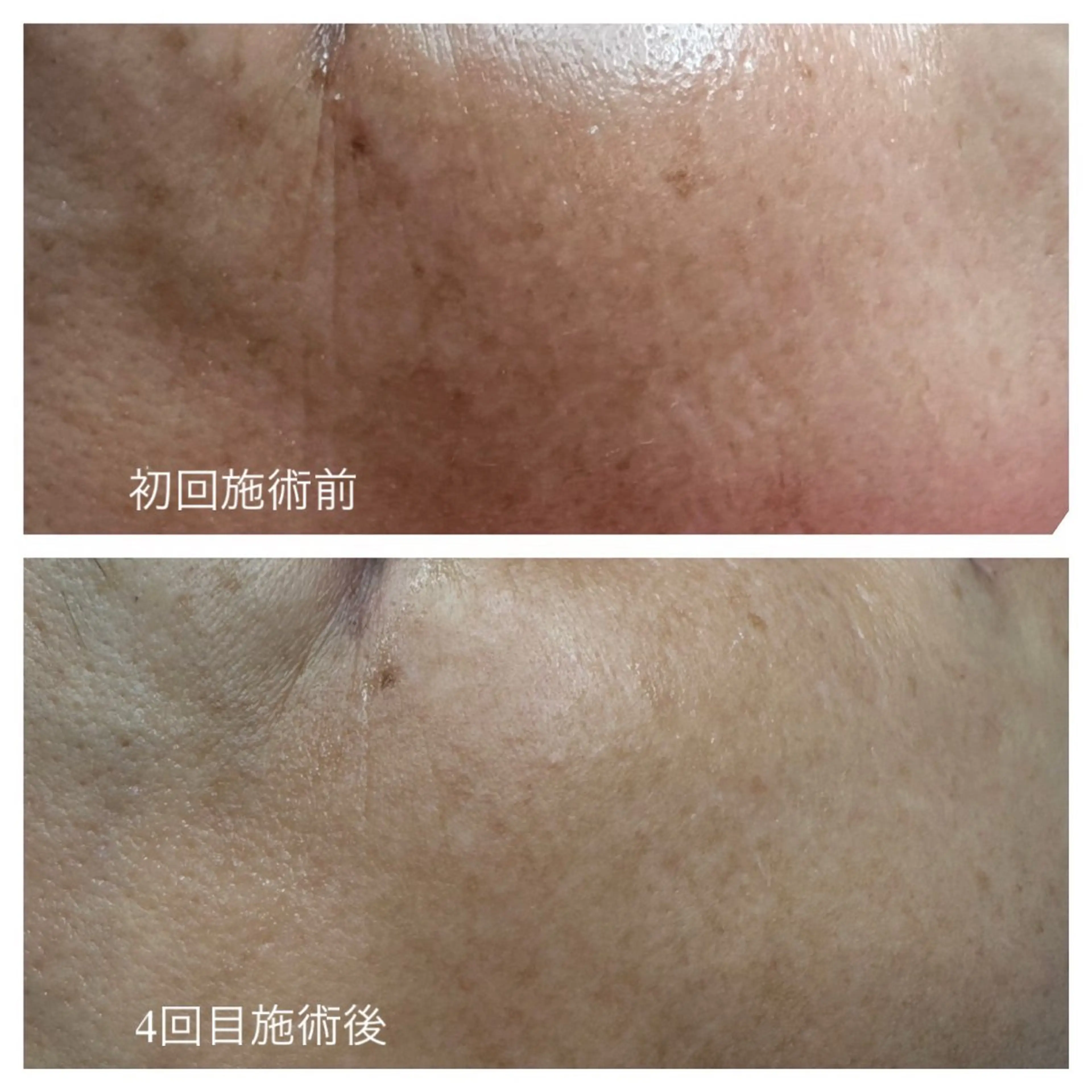 エステ スリーエスプラス内　美肌サロンEme所属・希映 -kieのエステ・リラクイメージ