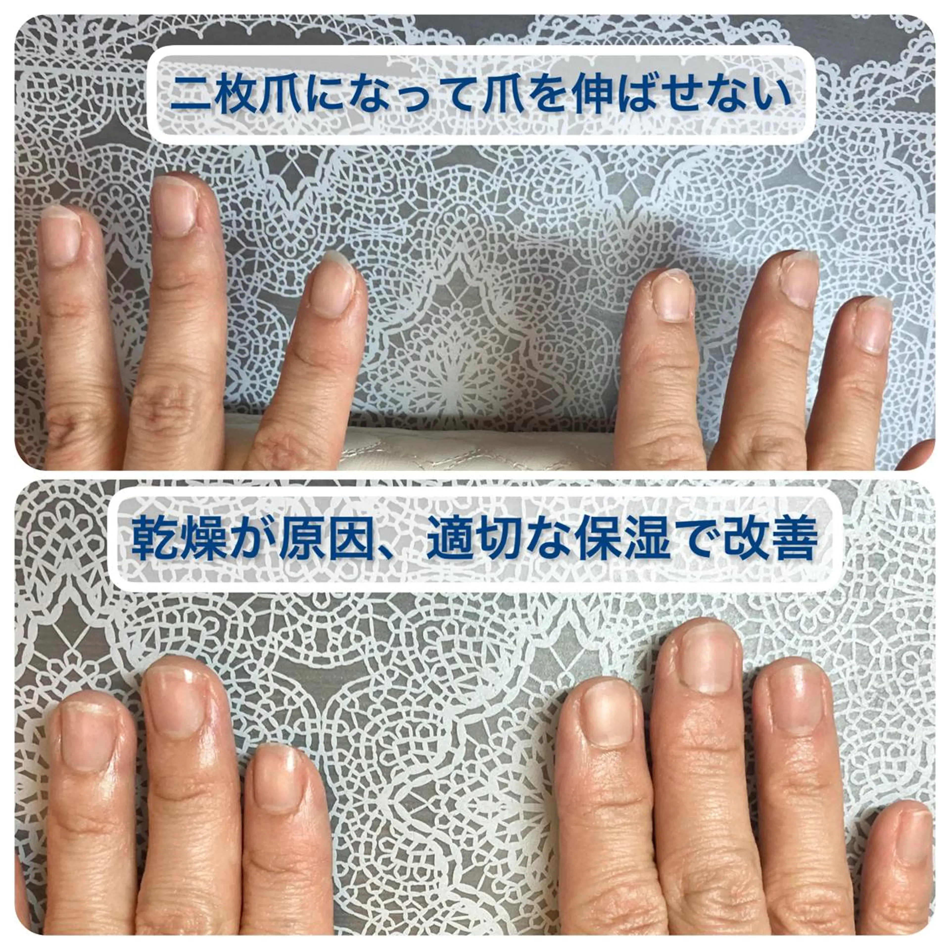 メンズ ネイル ピンク ケアリスト🍀 マリユキのネイルデザイン