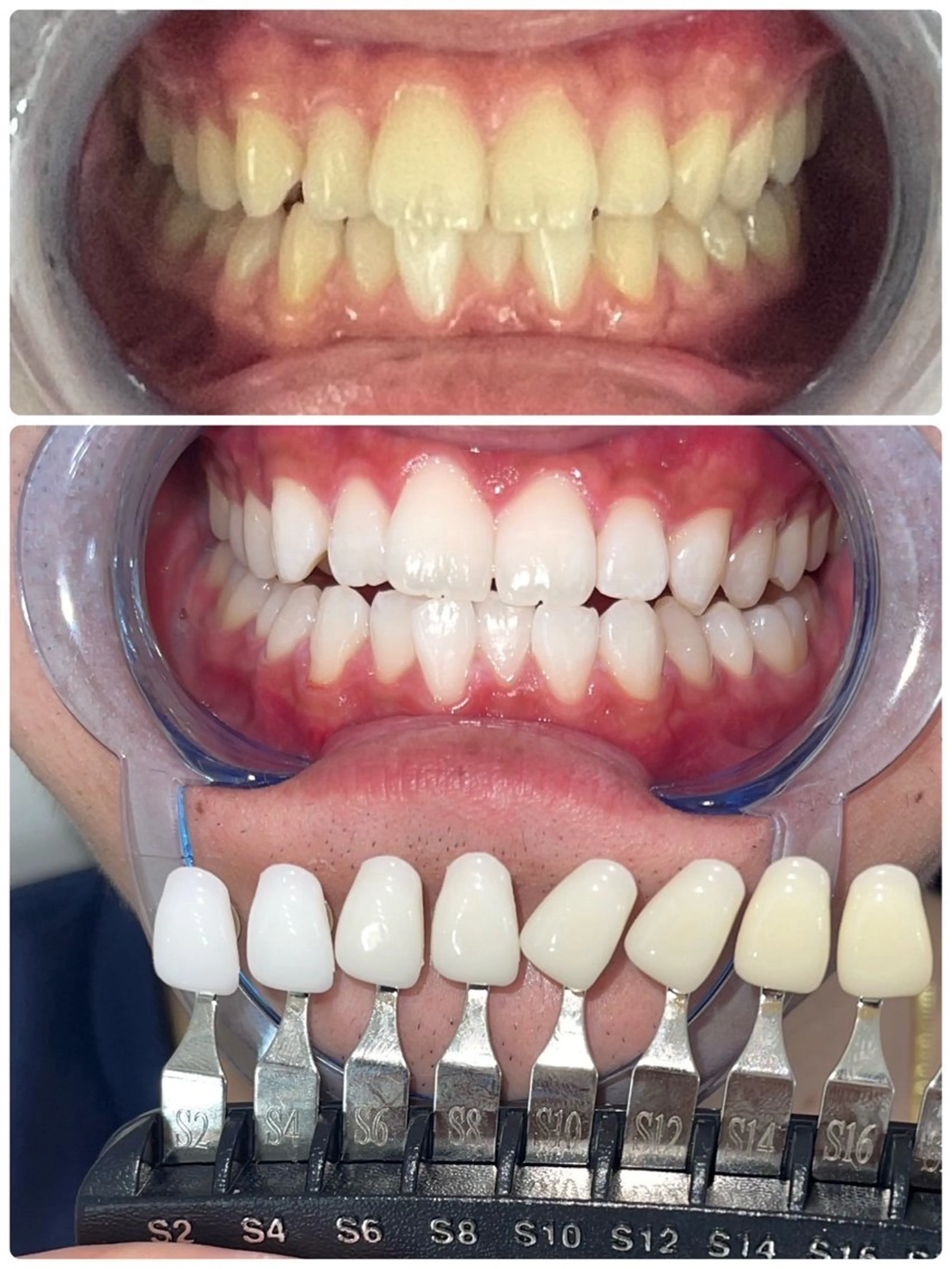 セルフホワイトニング エクシア徳島店マユのその他イメージ