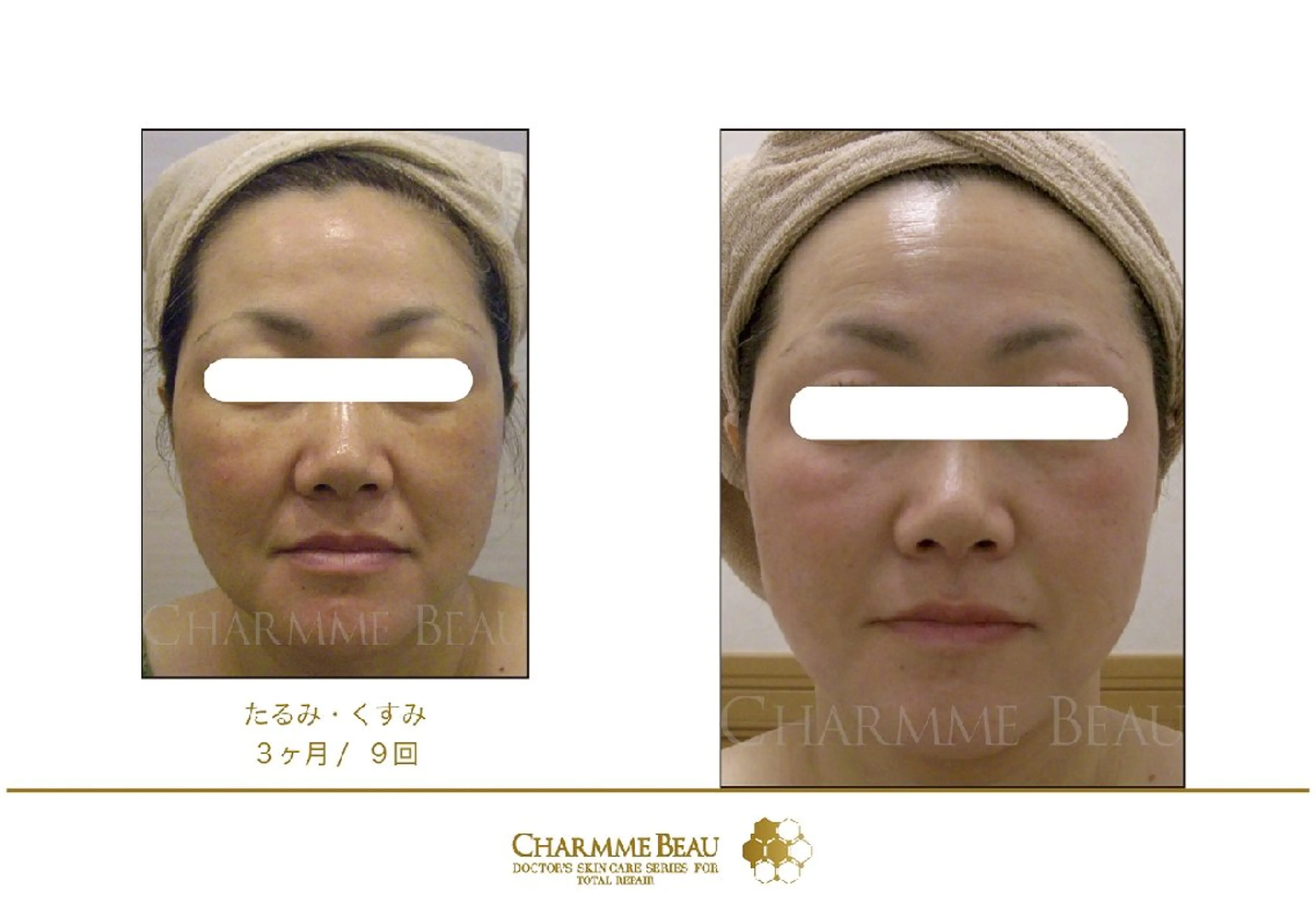 肌質改善サロン renew/ｳｴｷのエステ・リラクイメージ