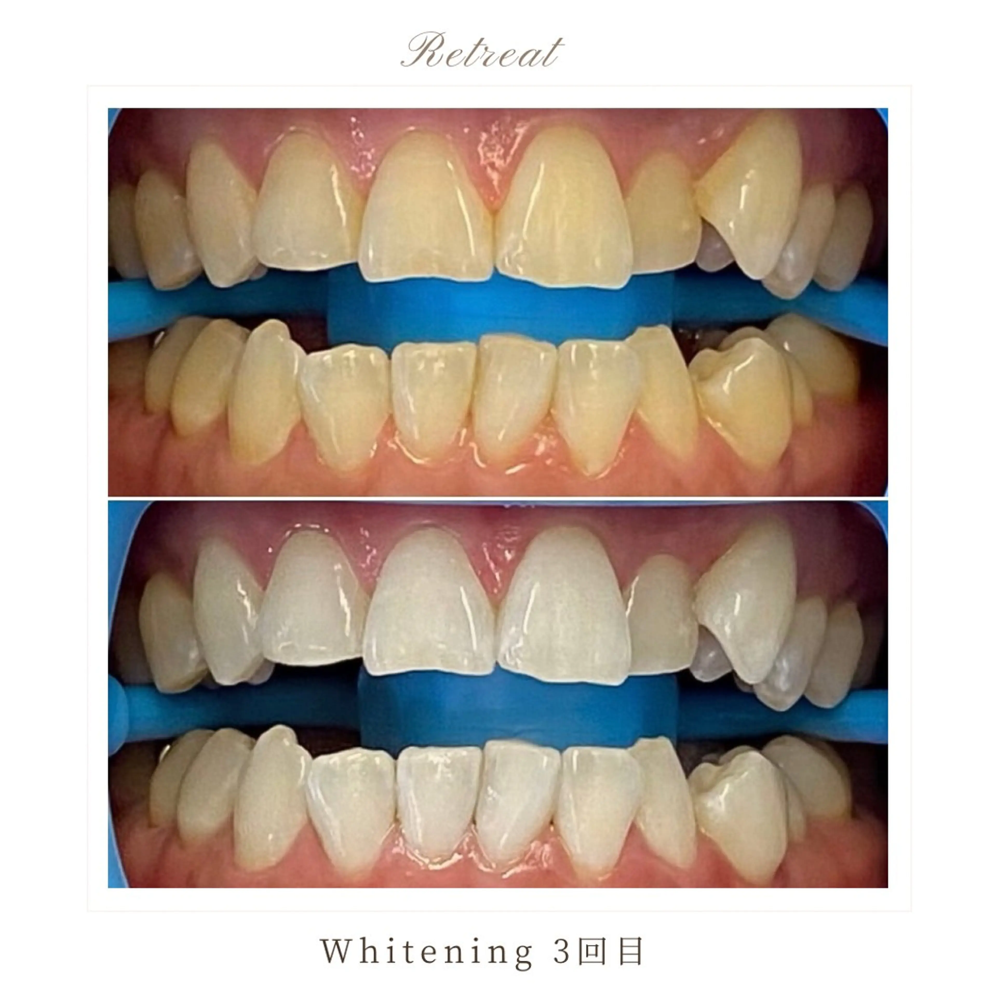 Retreatリトリート所属・歯科医院提携 Retreatのエステ・リラクイメージ