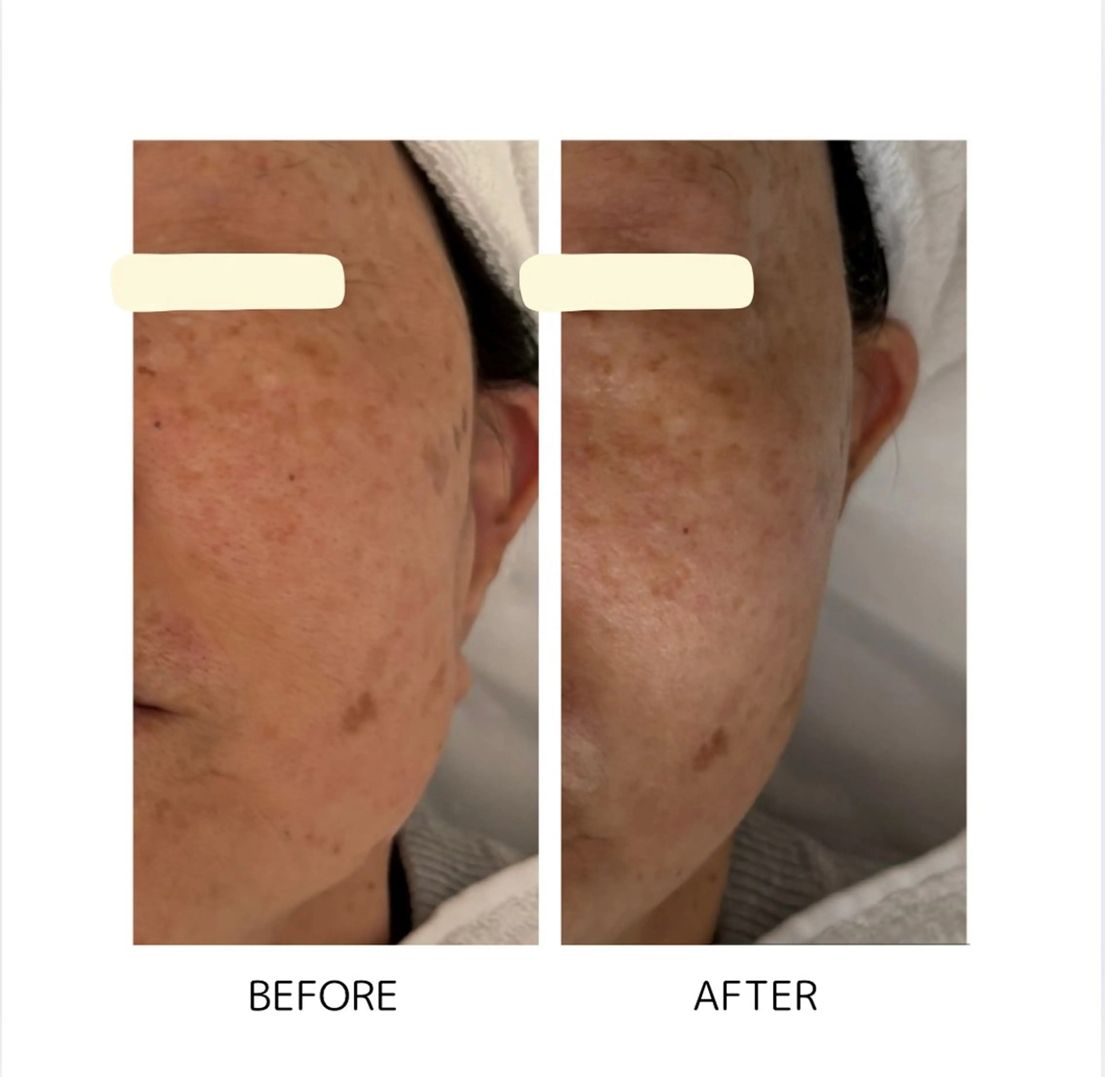 Yoshino Erinaのエステ・リラクイメージ